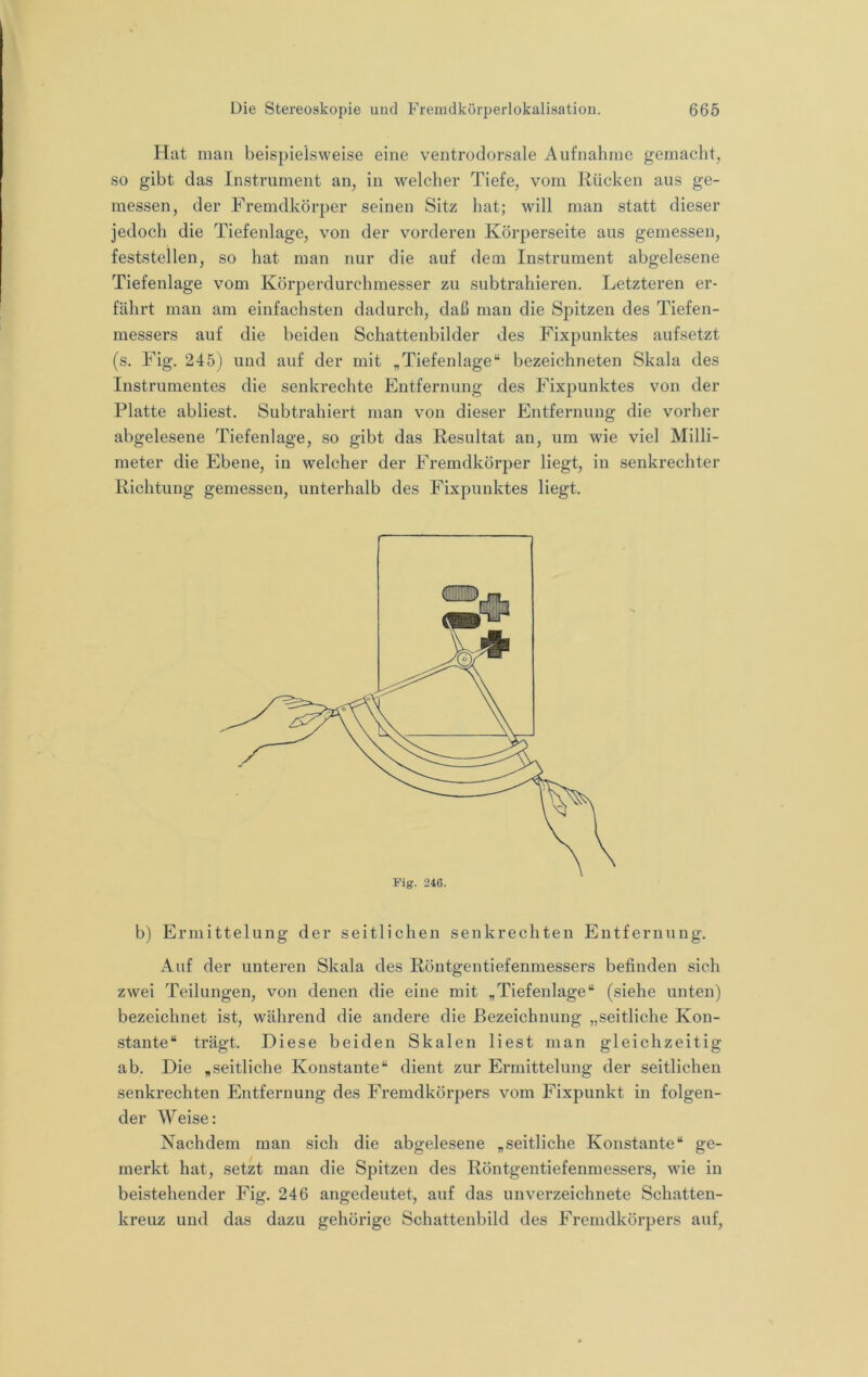 Hat man beispielsweise eine ventrodorsale Aufnahme gemacht, so gibt das Instrument an, in welcher Tiefe, vom Rücken aus ge- messen, der Fremdkörper seinen Sitz hat; will man statt dieser jedoch die Tiefenlage, von der vorderen Körperseite aus gemessen, feststellen, so hat man nur die auf dem Instrument abgelesene Tiefenlage vom Körperdurchmesser zu subtrahieren. Letzteren er- fährt man am einfachsten dadurch, daß man die Spitzen des Tiefen- messers auf die beiden Schattenbilder des Fixpunktes aufsetzt (s. Fig. 245) und auf der mit „Tiefenlage“ bezeichneten Skala des Instrumentes die senkrechte Entfernung des Fixpunktes von der Platte abliest. Subtrahiert man von dieser Entfernung die vorher abgelesene Tiefenlage, so gibt das Resultat au, um wie viel Milli- meter die Ebene, in welcher der Fremdkörper liegt, in senkrechter Richtung gemessen, unterhalb des Fixpunktes liegt. Fig. 246. b) Ermittelung der seitlichen senkrechten Entfernung. Auf der unteren Skala des Röntgentiefenmessers befinden sich zwei Teilungen, von denen die eine mit „Tiefenlage“ (siehe unten) bezeichnet ist, während die andere die Bezeichnung „seitliche Kon- stante“ trägt. Diese beiden Skalen liest man gleichzeitig ab. Die „seitliche Konstante“ dient zur Ermittelung der seitlichen senkrechten Entfernung des Fremdkörpers vom Fixpunkt in folgen- der Weise: Nachdem man sich die abgelesene „seitliche Konstante“ ge- merkt hat, setzt man die Spitzen des Röntgentiefenmessers, wie in beistehender Fig. 246 angedeutet, auf das unverzeichnete Schatten- kreuz und das dazu gehörige Schattenbild des Fremdkörpers auf.