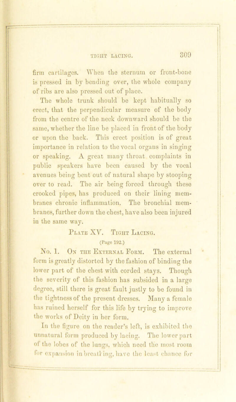 firm cartilages. When the sternum or front-bone is pressed in by bending over, the whole company of ribs are also pressed out of place. The whole trunk should be kept habitually so erect, that the perpendicular measure of the body from the centre of the neck downward should be the same, whether the line be placed in front of the body or upon the back. This erect position is of great importance in relation to the vocal organs in singing or speaking. A great many throat complaints in public speakers have been caused by the vocal avenues being bent out of natural shape by stooping over to read. The air being forced through these crooked pipes, has produced on their lining mem- branes chronic inflammation. The bronchial mem- branes, further down the chest, have also been injured in the same way. Plate XV. Tight Lacing. (Page 192.) No. 1. Ox tiie External Form. The external form is greatly distorted by the fashion of binding the lower part of the chest with corded stays. Though the severity of this fashion has subsided in a large degree, still there is great fault justly to be found in the tightness of the present dresses. Many a female has ruined herself for this life by trying to improve the works of Deity in her form. In the figure on the reader’s left, is exhibited the unnatural form produced by lacing. The lower part of the lobes of the lungs, which need the most room fur expansion in brcutlring, have the least chance for