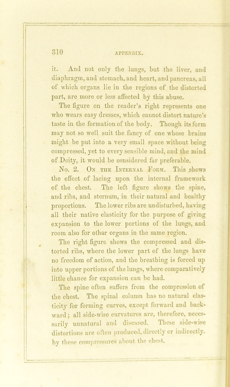 it. And not only the lungs, but the liver, and diaphragm, and stomach, and heart, and pancreas, all of which organs lie in the regions of the distorted part, are more or less affected by this abuse. The figure on the reader’s right represents one who wears easy dresses, which cannot distort nature’s taste in the formation of the body. Though its form may not so well suit the fancy of one whose brains might be put into a very small space without being compressed, yet to every sensible mind, and the mind of Deity, it would be considered far preferable. No. 2. Ox the Internal Form. This shows the effect of lacing upon the internal framework of the chest. The left figure shows the spine, and ribs, and sternum, in their natural and healthy proportions. The lower ribs are undisturbed, having all their native elasticity for the purpose of giving expansion to the lower portions of the lungs, and room also for other organs in the same region. The right figure shows the compressed and dis- torted ribs, where the lower part of the lungs have no freedom of action, and the breathing is forced up into upper portions of the lungs, where comparatively little chance for expansion can be had. The spine often suffers from the compression of the chest. The spinal column has no natural elas- ticity for forming curves, except forward and back- ward ; all side-wise curvatures are, therefore, neces- sarily unnatural and diseased. These side-wise distortions are often produced, directly or indirectly, by these eompressures about the chest.