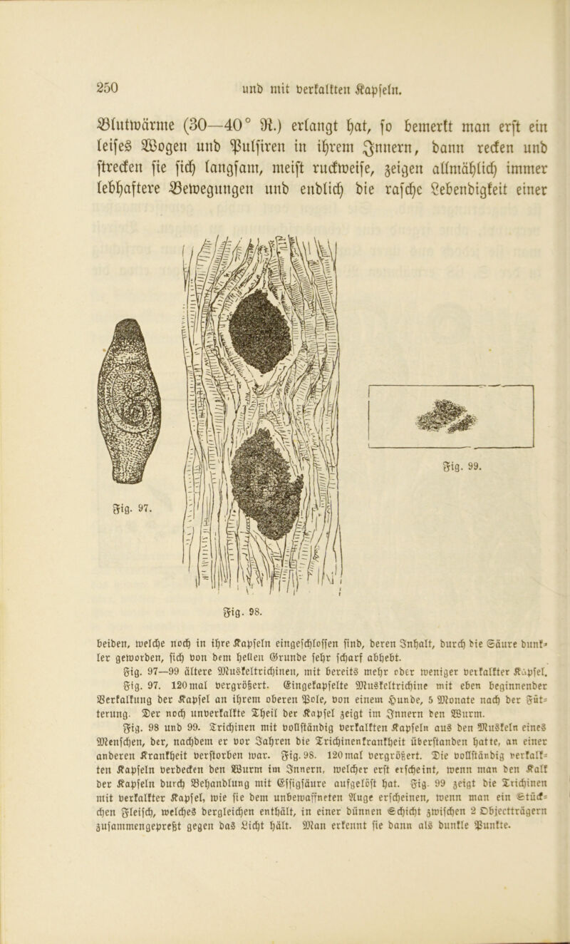 331uttoärme (30—40° $R.) erlangt fyat, fo bemertt man erft ein leifeg Söogen unb ^ulfiren in ihrem Innern, bann reden unb ftreden fte fid^ langfam, meift rudtoeife, geigen allmählich immer lebhaftere 33etoegungen unb enblid) bie rafcfye Sebenbigfeit einer 3i0. 93. beiben, tueldje nod) in ifjre tfapfeln eingefd)loffen finb, beren Snfjalt, burdj bie (Säure bunf* ler geworben, fidj bon bent feilen ©runbe feljr fdjarf abljebt. gig. 97—99 ältere SUtuSfeltrichineu, mit bereits mefjr ober weniger bertalfter Jfabfel. #ig. 97. 120mal bergrö&ert. (Singefapfelte -JJtuSfeltrichine mit eben beginnenber SSerfaltung ber Jbabfel an ihrem oberen $ole, üon einem §unbe, 5 Sftonate nad) ber f$üt= terung. Ser nod) unbertalfte 5Tf)eiI ber Zapfet geigt im Innern ben SBurm. $ig. 98 unb 99. S:ridf)inen mit boflftänbig berfalften tfabfeln auS ben 3RuSfeIn eines 9J?enfd)en, ber, nad)bent er bor Satjren bie Sridjinenfranfbeit überftanben fjatte, an einet anbereu Äranttjeit berftorben war. gig. 9S. 120 mal bergröfeert. Sie boüftänbig nerfalf= ten Ibabfeln berbeden ben SSurm im Snnern, welcher erft etfcbeint, wenn man ben d?alf ber tfapfeln burd) Söefjanblung mit ©ffigfäure aufgeloft bat. fjig. 99 geigt bie Srid)inen mit berfalfter tfapfel, wie fie bem unbewaffneten 2luge erfdjeinen, wenn man ein Stücf= d)en Sleifdb, welches bergleicfjett enthält, in einer biinnen Schicht gwifdjen 2 Dbjectträgern gufammengepreBt gegen baS Sicht hält. SOiait erfennt fie bann als bunfle fünfte.