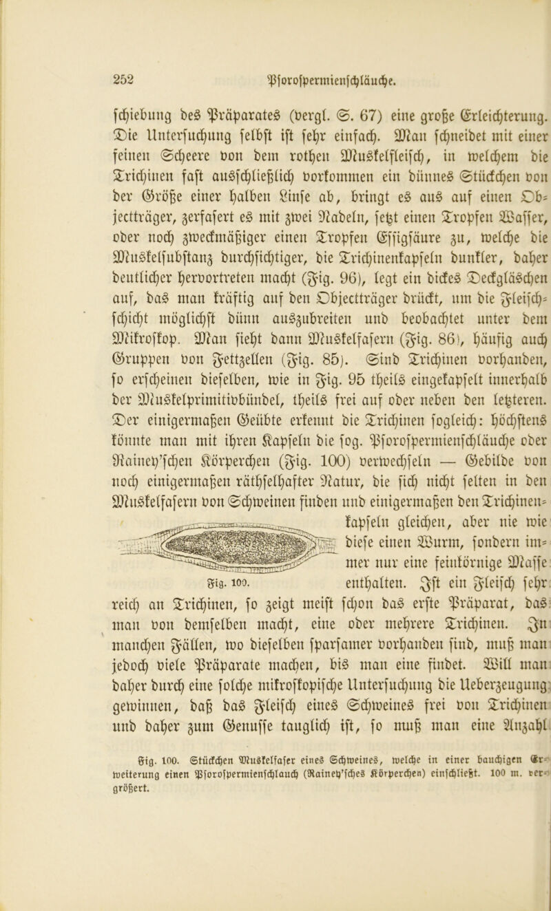 fdjiebung be£ Präparates (bergt. ©. 67) eine große Erleichterung. Oie Unterfnchnng fetbft ift fetjr einfach- 2ttau fchneibet mit einer feinen ©cheere bon bem rotten 2)2uStetfteifch, in meinem bie Trichinen faft auSfchtießtich borfommen ein bünneS ©tiicfchen bon ber ©röße einer halben $infe ab, bringt eS au£ auf einen Db= jectträger, gerfafert eS mit gtoei fabeln, fefet einen tropfen 2Baffer, ober noch gtoedmäßiger einen tropfen Effigfäure gu, toetche bie 2)cuStetfubftang burd)fid)tiger, bie Orid)inenfapfetn bunfter, baher beutticher herbortreten macht (gig. 96), legt ein bicfe^ OedgtäSchen auf, baS man fräftig auf ben Objectträger brüdt, um bie gteifd)5 fd)id)t mbglichft biiun auSgubreiten uub beobachtet unter bem SD^ifroffop. 2ftan fieht bann 2)?uSf eifafern (gig. 86), häufig auch ©ruppen bon gettgelten (gig. 85). ©inb Trichinen borhanben, fo erscheinen biefelben, mie in gig. 95 theilS eingefapfelt innerhalb ber 2JiuStetprimitibbünbet, theitS frei auf ober neben ben teueren. Oer einigermaßen ©eübte erfenut bie Trichinen fogteich: hächften^ tonnte man mit ihren Kapfelu bie fog. Pforofpermienfchtäuche ober SRainepfchen Körperchen (g*ig. 100) bertoedjfetn — ©ebilbe bon noch einigermaßen räthfethafter Sftatur, bie fidj nicht fetten in ben SftuSf eifafern bon ©drehten fiuben unb einigermaßen ben Stridjineu* fapfetu gleichen, aber nie rnie biefe einen 2Öurm, fonbern im- mer nur eine feiutörnige äftaffe 3fi8. ioo. enthatten. gft ein gteifdj fehr reich an Trichinen, fo geigt meift fd)on baS erfte Präparat, baS man bon bemfetben macht, eine ober mehrere Orid)inen. gtt manchen gatten, mo biefetbeu fparfamer borhanben finb, muß man jeboch biete Präparate machen, bis man eine finbet. SS3itt mau baher burdh eine fotdje mitroffopifche Unterfuchuug bie Uebergeugung gewinnen, baß baS gteifd) eines ©d)tbeineS frei bon Trichinen unb baher gum ©enuffe taugtid) ift, fo muß man eine 2lugaljt gig. 100. «StücTd^cn 90iuSIeIfafer eines ©djtoeineS, tueld^e in einer bauchigen &r- Weiterung einen $forofaermienfdjlaud) (SRainetTfdjeS ßörperdjen) einfc^Iiefet. 100 m. ret^ gröfcert.