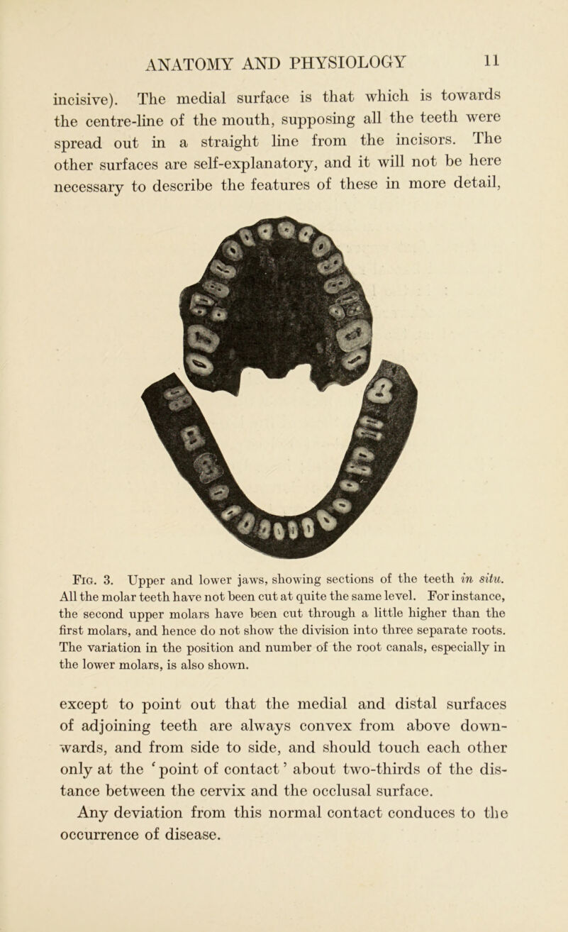 incisive). The medial surface is that which is towards the centre-line of the mouth, supposing all the teeth were spread out in a straight line from the incisors. The other surfaces are self-explanatory, and it will not be here necessary to describe the features of these in more detail, Fig. 3. Upper and lower jaws, showing sections of the teeth in situ. All the molar teeth have not been cut at quite the same level. For instance, the second upper molars have been cut through a little higher than the first molars, and hence do not show the division into three separate roots. The variation in the position and number of the root canals, especially in the lower molars, is also shown. except to point out that the medial and distal surfaces of adjoining teeth are always convex from above down- wards, and from side to side, and should touch each other only at the ‘ point of contact ’ about two-thirds of the dis- tance between the cervix and the occlusal surface. Any deviation from this normal contact conduces to the occurrence of disease.