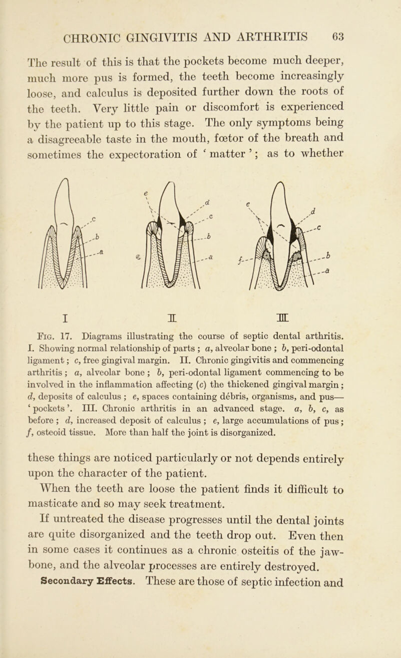 The result of this is that the pockets become much deeper, much more pus is formed, the teeth become increasingly loose, and calculus is deposited further down the roots of the teeth. Very little pain or discomfort is experienced by the patient up to this stage. The only symptoms being a disagreeable taste in the mouth, foetor of the breath and sometimes the expectoration of ‘ matter 5; as to whether I JL HE Fig. 17. Diagrams illustrating the course of septic dental arthritis. I. Showing normal relationship of parts ; a, alveolar bone ; b, peri-odontal ligament; c, free gingival margin. II. Chronic gingivitis and commencing arthritis ; a, alveolar bone ; b, peri-odontal ligament commencing to be involved in the inflammation affecting (c) the thickened gingival margin; d, deposits of calculus ; e, spaces containing debris, organisms, and pus— ‘ pockets ’. III. Chronic arthritis in an advanced stage, a, b, c, as before ; d, increased deposit of calculus ; e, large accumulations of pus; /, osteoid tissue. More than half the joint is disorganized. these things are noticed particularly or not depends entirely upon the character of the patient. When the teeth are loose the patient finds it difficult to masticate and so may seek treatment. If untreated the disease progresses until the dental joints are quite disorganized and the teeth drop out. Even then in some cases it continues as a chronic osteitis of the jaw- bone, and the alveolar processes are entirely destroyed. Secondary Effects. These are those of septic infection and