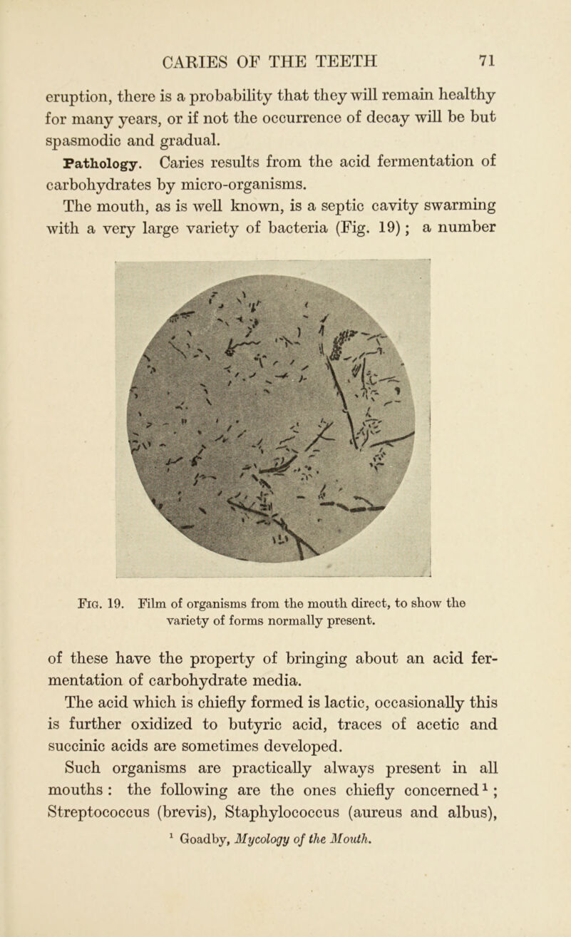 eruption, there is a probability that they will remain healthy for many years, or if not the occurrence of decay will be but spasmodic and gradual. Pathology. Caries results from the acid fermentation of carbohydrates by micro-organisms. The mouth, as is well known, is a septic cavity swarming with a very large variety of bacteria (Fig. 19); a number Fig. 19. Film of organisms from the month direct, to show the variety of forms normally present. of these have the property of bringing about an acid fer- mentation of carbohydrate media. The acid which is chiefly formed is lactic, occasionally this is further oxidized to butyric acid, traces of acetic and succinic acids are sometimes developed. Such organisms are practically always present in all mouths : the following are the ones chiefly concerned1; Streptococcus (brevis), Staphylococcus (aureus and albus), 1 Goadby, Mycology of the Mouth.