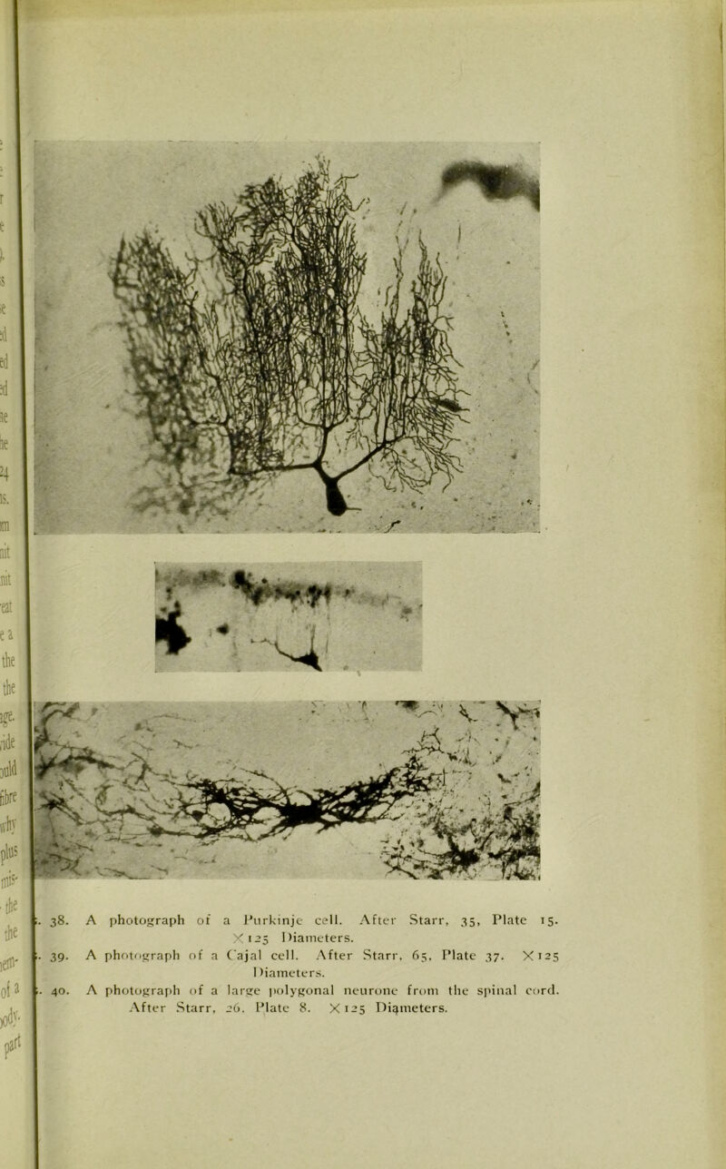 X125 Diameters photograph of a C'ajal cell. After Starr, 65, Plate 37. X125 1 Hameters. photograph of a large polygonal neurone from the spinal cord. After Starr, 26. Plate 8. X125 Diameters. i 1