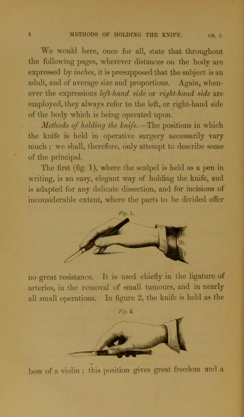 We would here, once for all, state that throughout the following pages, wherever distances on the body are expressed by inches, it is presupposed that the subject is an adult, and of average size and proportions. Again, when- ever the expressions left-hand side or right-hand side are employed, they always refer to the left, or right-hand side of the body which is being operated upon. Methods of holding the knife.—The positions in which the knife is held in operative surgery necessarily vary much ; we shall, therefore, only attempt to describe some of the principal. The first (fig. 1), where the scalpel is held as a pen in writing, is an easy, elegant way of holding the knife, and is adapted for any delicate dissection, and for incisions of inconsiderable extent, where the parts to be divided offer Fig. 1. no great resistance. It is used chiefly in the ligature of arteries, in the removal of small tumours, and in nearly all small operations. In figure 2, the knife is held as the Fig. 2. ♦ bow of a violin ; this position gives great freedom and a