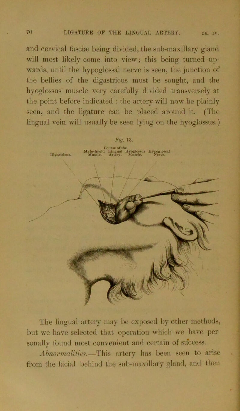 and cervical fasciae being divided, the sub-maxillary gland will most likely come into view; this being turned up- wards, until the hypoglossal nerve is seen, the junction of the bellies of the digastricus must be sought, and the hyoglossus muscle very carefully divided transversely at the point before indicated : the artery will now be plainly seen, and the ligature can be placed around it. (The lingual vein will usually be seen lying on the hyoglossus.) Digastricus. Fiy. 13. Course of the Mylo-hyoid Lingual Hyoglossus Hypoglossal Muscle. Artery. Muscle. Nerve. The lingual artery may be exposed by other methods, but we have selected that operation which we have per- sonally found most convenient and certain of success. Abnormalities.—This artery lias been seen to arise from the facial behind the sub-maxillary gland, and then
