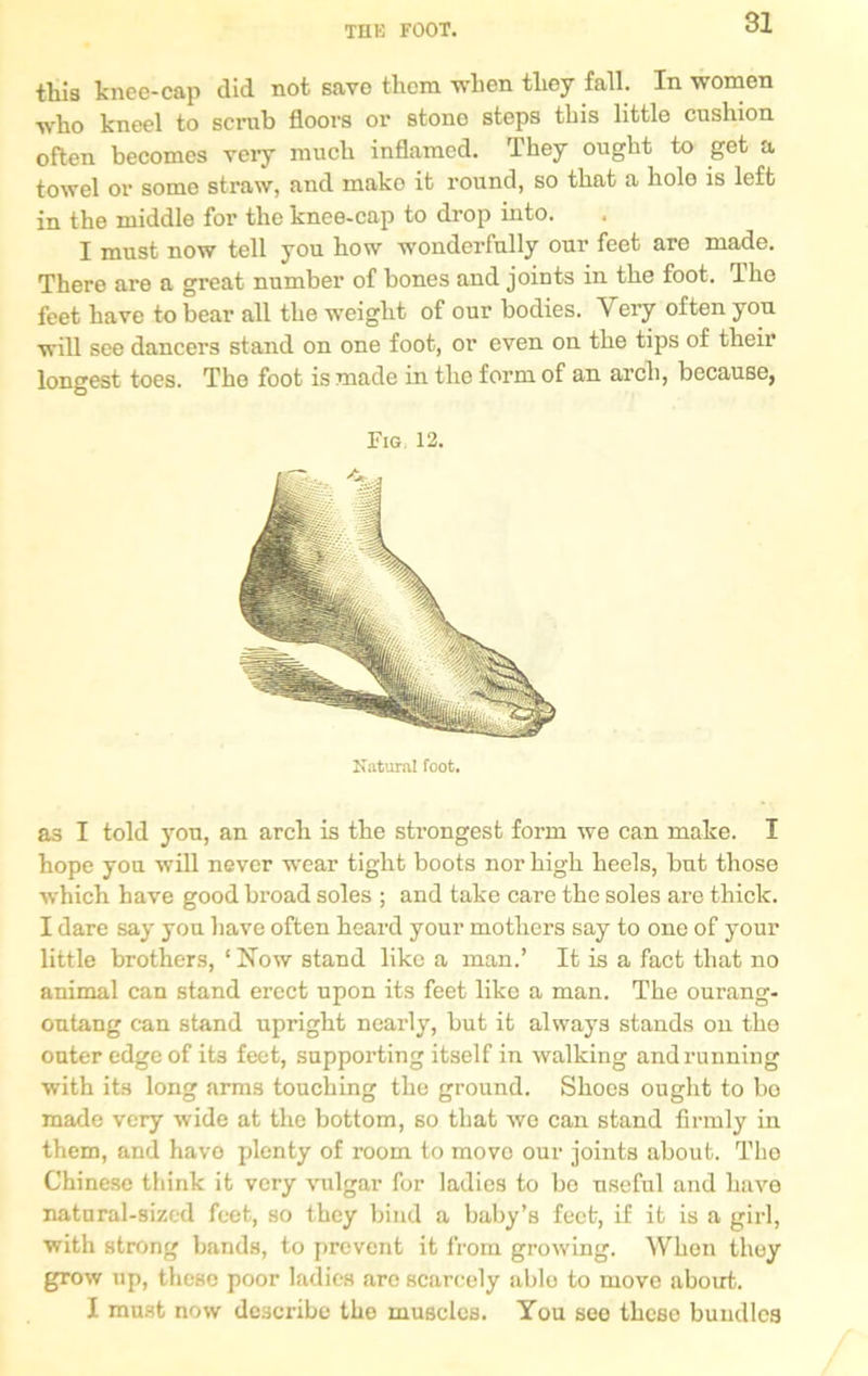 THK FOOT. this knee-cap did not save them when they fall. In women who kneel to scrub floors or stono steps tbis little cushion often becomes veiy much inflamed. They ought to get a towel or some straw, and mako it round, so that a holo is left in the middle for the knee-cap to drop into. I must now tell you how wonderfully our feet are made. There are a great number of bones and joints in the foot. The feet have to bear all the weight of our bodies. A ery often yon will see dancers stand on one foot, or even on the tips of their longest toes. The foot is made in the form of an arch, because, Fig 12. Natural foot. a3 I told yon, an arch is the strongest form we can make. I hope yon will never wear tight boots nor high heels, bnt those which have good broad soles ; and take care the soles are thick. I dare say yon have often heard your mothers say to one of your little brothers, ‘ Now stand like a man.’ It is a fact that no animal can stand erect upon its feet like a man. The ourang- outang can stand upright nearly, but it always stands on the outer edge of it3 feet, supporting itself in walking and running with its long arms touching the ground. Shoes ought to bo made very wide at the bottom, so that we can stand firmly in them, and have plenty of room to move our joints about. The Chinese think it very vulgar for ladies to be useful and have natural-sized feet, so they bind a baby’s feet, if it is a girl, with strong bands, to prevent it from growing. AVhen they grow up, these poor ladies are scarcely able to move about. I must now describe the muscles. You see these bundles