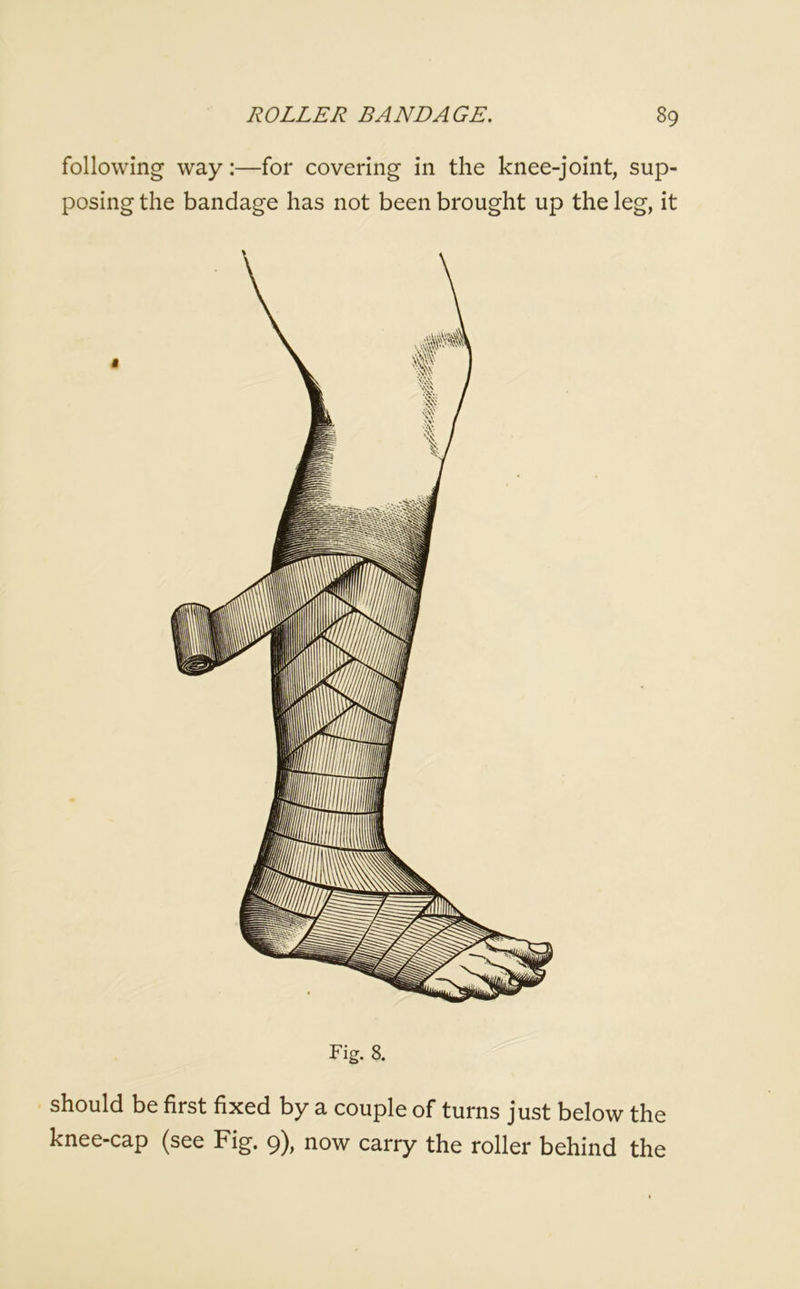 following way:—for covering in the knee-joint, sup- posing the bandage has not been brought up the leg, it Fig. 8. should be first fixed by a couple of turns just below the knee-cap (see Fig. 9), now carry the roller behind the