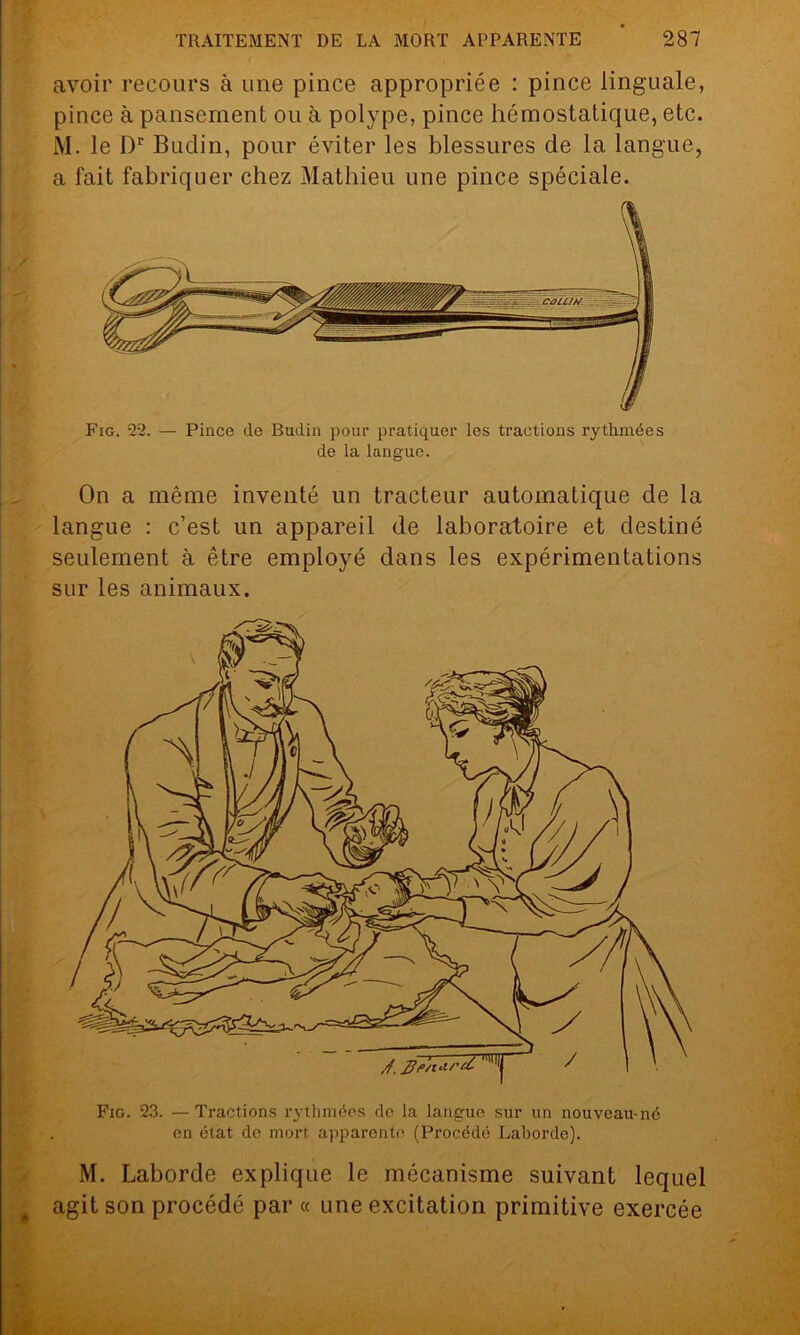 Fig. 23. —Tractions rythmées de la langue sur un nouveau-né en état de mort apparente (Procédé Laborde). M. Laborde explique le mécanisme suivant lequel agit son procédé par « une excitation primitive exercée TRAITEMENT DE LA MORT APPARENTE  287 avoir recours à une pince appropriée : pince linguale, pince à pansement ou à polype, pince hémostatique, etc. i\I. le Dr Budin, pour éviter les blessures de la langue, a fait fabriquer chez Mathieu une pince spéciale. Fig. 22. — Pince de Budin pour pratiquer les tractions rythmées de la langue. On a même inventé un tracteur automatique de la langue : c’est un appareil de laboratoire et destiné seulement à être employé dans les expérimentations sur les animaux.