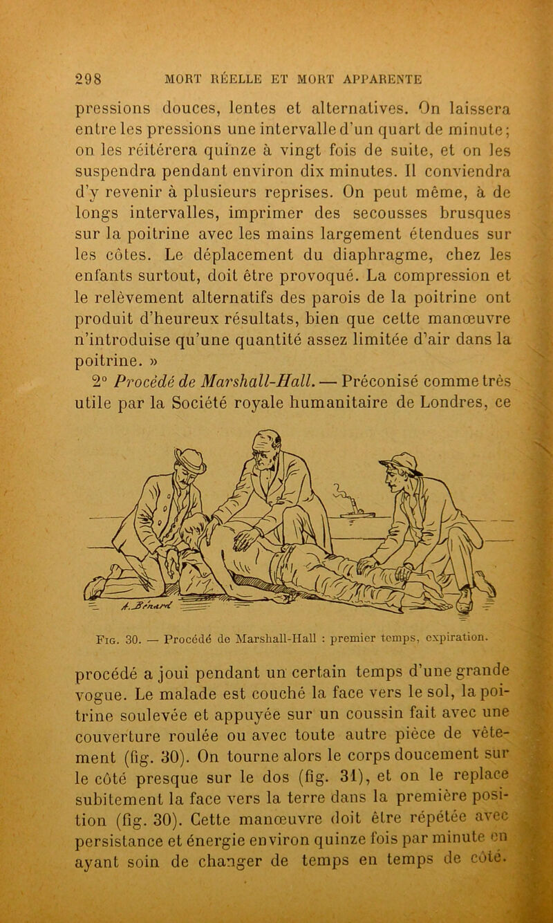 pressions douces, lentes et alternatives. On laissera entre les pressions une intervalle d'un quart de minute ; on les réitérera quinze à vingt fois de suite, et on les suspendra pendant environ dix minutes. Il conviendra d’y revenir à plusieurs reprises. On peut même, à de longs intervalles, imprimer des secousses brusques sur la poitrine avec les mains largement étendues sur les côtes. Le déplacement du diaphragme, chez les enfants surtout, doit être provoqué. La compression et le relèvement alternatifs des parois de la poitrine ont produit d’heureux résultats, bien que cette manœuvre n’introduise qu’une quantité assez limitée d’air dans la poitrine. » 2° Procédé de Marshall-Hall. — Préconisé comme très utile par la Société royale humanitaire de Londres, ce Fig. 30. — Procédé de Marshall-Hall : premier temps, expiration. procédé a joui pendant un certain temps d’une grande vogue. Le malade est couché la face vers le sol, la poi- trine soulevée et appuyée sur un coussin fait avec une couverture roulée ou avec toute autre pièce de vête- ment (fig. 30). On tourne alors le corps doucement sur le côté presque sur le dos (fig. 31), et on le replace subitement la face vers la terre dans la première posi- tion (fig. 30). Cette manœuvre doit être répétée avec persistance et énergie environ quinze lois par minute en ayant soin de changer de temps en temps de côte.