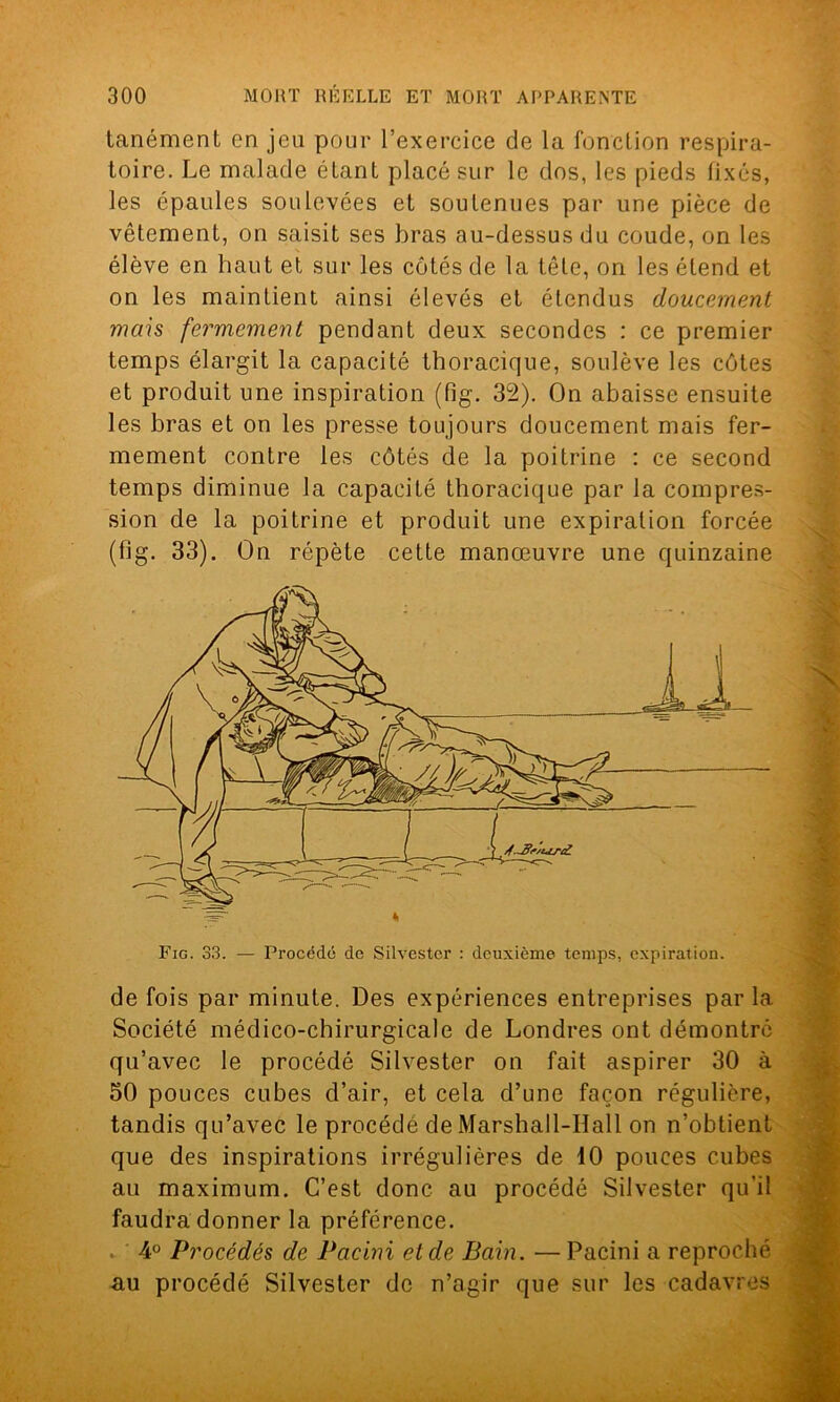 tanément en jeu pour l’exercice de la fonction respira- toire. Le malade étant placé sur le dos, les pieds fixés, les épaules soulevées et soutenues par une pièce de vêtement, on saisit ses bras au-dessus du coude, on les élève en haut et sur les côtés de la tête, on les étend et on les maintient ainsi élevés et étendus doucement mais fermement pendant deux secondes : ce premier temps élargit la capacité thoracique, soulève les côtes et produit une inspiration (fig. 32). On abaisse ensuite les bras et on les presse toujours doucement mais fer- mement contre les côtés de la poitrine : ce second temps diminue la capacité thoracique par la compres- sion de la poitrine et produit une expiration forcée (fig. 33). On répète cette manœuvre une quinzaine Fig. 33. — Procédé de Silvestcr : deuxième temps, expiration. de fois par minute. Des expériences entreprises par la Société médico-chirurgicale de Londres ont démontre qu’avec le procédé Silvester on fait aspirer 30 à 50 pouces cubes d’air, et cela d’une façon régulière, tandis qu’avec le procédé de Marshall-Hall on n’obtient que des inspirations irrégulières de 10 pouces cubes au maximum. C’est donc au procédé Silvester qu'il faudra donner la préférence. 4° Procédés de Pacini et de Bain. —Pacini a reproché au procédé Silvester de n’agir que sur les cadavres