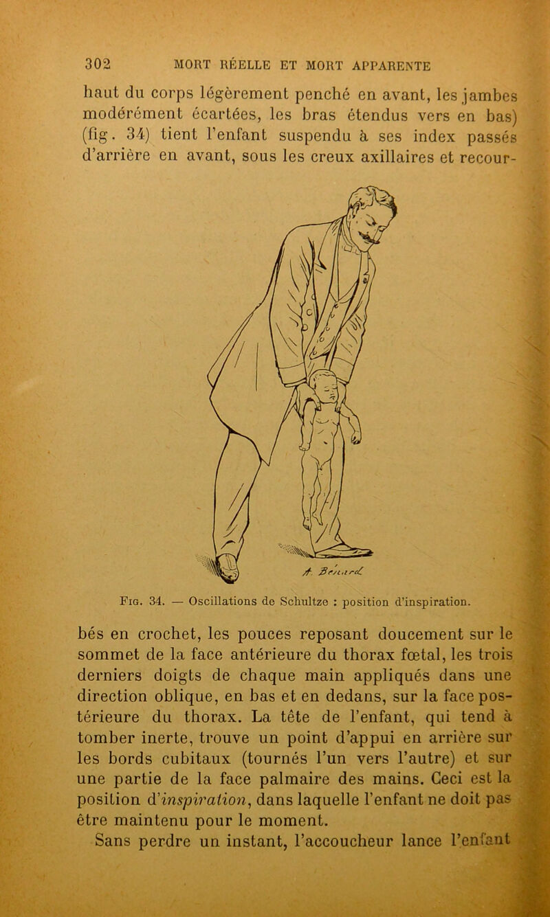 haut du corps légèrement penché en avant, les jambes modérément écartées, les bras étendus vers en bas) (fig. 34) tient l’enfant suspendu à ses index passés d’arrière en avant, sous les creux axillaires et recour- Fig. 34. — Oscillations de Schultze : position d’inspiration. bés en crochet, les pouces reposant doucement sur le sommet de la face antérieure du thorax fœtal, les trois derniers doigts de chaque main appliqués dans une direction oblique, en bas et en dedans, sur la face pos- térieure du thorax. La tête de l’enfant, qui tend à tomber inerte, trouve un point d’appui en arrière sur les bords cubitaux (tournés l’un vers l’autre) et sur une partie de la face palmaire des mains. Ceci est la position d'inspiration, dans laquelle l’enfant ne doit pas être maintenu pour le moment. Sans perdre un instant, l’accoucheur lance l’enfant *