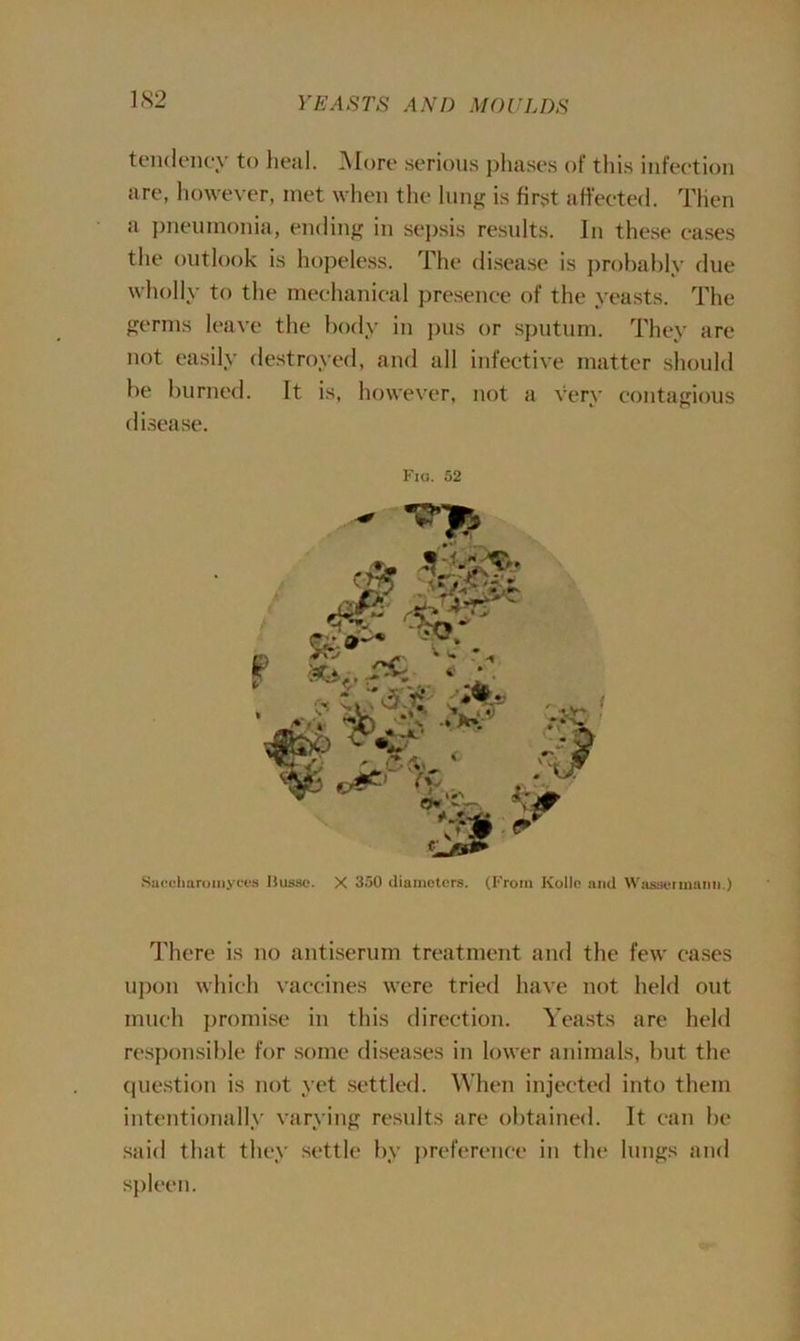 tendency to heal. More serious phases of this infection are, however, met when the lung is first affected. Then a pneumonia, ending in sepsis results. In these eases the outlook is hopeless. The disease is probably due wholly to the mechanical presence of the yeasts. The germs leave the body in pus or sputum. They are not easily destroyed, and all infective matter should be burned. It is, however, not a very contagious disease. Fig. 52 Saecharoinyces liussc. X 350 diameters. (From Kollo and Wassertnann.) There is no antiserum treatment and the few cases upon which vaccines were tried have not held out much promise in this direction. Yeasts are held responsible for some diseases in lower animals, but the question is not yet settled. When injected into them intentionally varying results are obtained. It can be said that they settle by preference in the lungs and spleen.