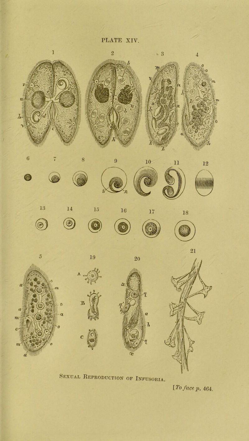 PLATE XIV. Sexual Reproduction of Infusoria [To facep. 464,