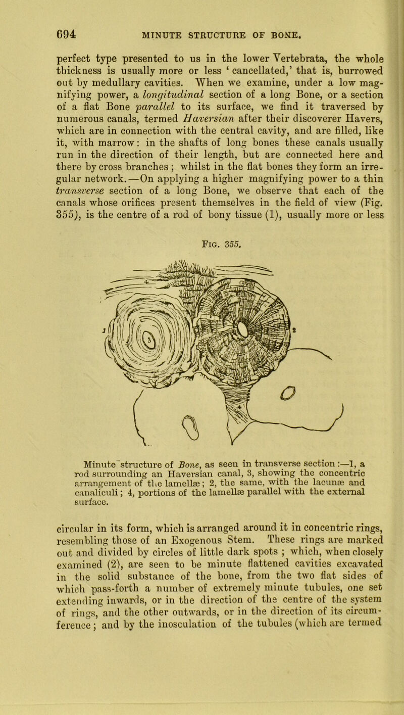 perfect type presented to us in the lower Vertebrata, the whole thickness is usually more or less ‘ cancellated,’ that is, burrowed ont by medullary cavities. When we examine, under a low mag- nifying power, a longitudinal section of a long Bone, or a section of a flat Bone 'parallel to its surface, we find it traversed by numerous canals, termed Haversian after their discoverer Havers, which are in connection with the central cavity, and are filled, like it, with marrow: in the shafts of long bones these canals usually run in the direction of their length, but are connected here and there by ci'oss branches ; whilst in the flat bones they form an irre- gular network.—On applying a higher magnifying power to a thin transverse section of a long Bone, we observe that each of the canals whose orifices present themselves in the field of view (Fig. 355), is the centre of a rod of bony tissue (1), usually more or less Fig. 355. Minute structure of Bone, as seeu in transverse section :—1, a rod surrounding an Haversian canal, 3, showing the concentric arrangement of the lamelke; 2, the same, with the lacunae and canaliculi; 4, portions of the lamellae parallel with the external surface. circular in its form, which is arranged around it in concentric rings, resembling those of an Exogenous Stem. These rings are marked out and divided by circles of little dark spots ; which, when closely examined (2), are seen to be minute flattened cavities excavated in the solid substance of the bone, from the two flat sides of which pass-forth a number of extremely minute tubules, one set extending inwards, or in the direction of the centre of the system of rings, and the other outwards, or in the direction of its circum- ference ; and by the inosculation of the tubules (which are termed