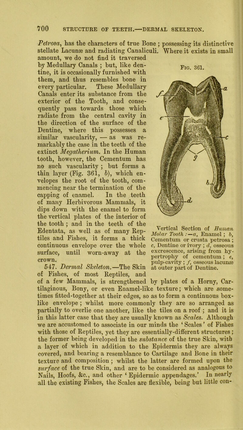 Fig. 361. Petrosa, has the characters of true Bone ; possessing its distinctive stellate Lacunae and radiating Canaliculi. Where it exists in small amount, we do not find it traversed by Medullary Canals ; but, like den- tine, it is occasionally furnished with them, and thus resembles bone in every particular. These Medullary Canals enter its substance from tbe exterior of the Tooth, and conse- quently pass towards those which radiate from the central cavity in the direction of the surface of the Dentine, where this possesses a similar vascularity, — as was re- markably the case in the teeth of the extinct Megatherium. In the Human tooth, however, the Cementum has no such vascularity ; but forms a thin layer (Fig. 361, b), which en- velopes the root of the tooth, com- mencing near the termination of the capping of enamel. In the teeth of many Herbivorous Mammals, it dips down with the enamel to form the vertical plates of the interior of the tooth ; and in the teeth of the Edentata, as well as of many Rep- tiles and Fishes, it forms a thick continuous envelope over the whole surface, until worn-away at the crown. 547. Dermal Skeleton.—The Skin of Fishes, of most Reptiles, and of a few Mammals, is strengthened by plates of a Horny, Car- tilaginous, Bony, or even Enamel-like texture; which are some- times fitted-together at their edges, so as to form a continuous box- like envelope ; whilst more commonly they are so arranged as partially to overlie one another, like the tiles on a roof ; and it is in this latter case that they are usually known as Scales. Although we are accustomed to associate in our minds the ‘ Scales ’ of Fishes with those of Reptiles, yet they are essentially-different structures ; the former being developed in the substance of the true Skin, with a layer of which in addition to the Epidermis they are always covered, and bearing a resemblance to Cartilage and Bone in their texture and composition ; whilst the latter are formed upon the surface of the true Skin, and are to be considered as analogous to Nails, Hoofs, &c., and other ‘ Epidermic appendages.’ In nearly all the existing Fishes, the Scales are flexible, being but little con- Vertical Section of Human Molar Tooth a, Enamel ; b, Cementum or crusta petrosa ; c, Dentine or ivory ; d, osseous excrescence, arising from hy- pertrophy of cementum; e, pulp-cavity ; /, osseous lacunse at outer part of Dentine.