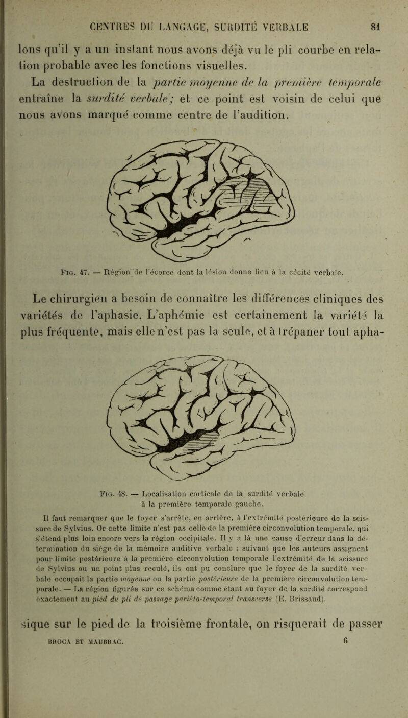 Ions qu’il y a un inslant nous avons déjà vu le pli courbe en rela- tion probable avec les fondions visuelles. La destruction de la joartie moyenne de la première temporale entraîne la surdité verbale; et ce point est voisin de celui que nous avons marqué comme centre de l’audition. Fig. 47. — Région de l’écorce dont la lésion donne lieu à la cécité verbale. Le chirurgien a besoin de connaître les différences cliniques des variétés de l’aphasie. L’aphémie est certainement la variété la plus fréquente, mais elle n’est pas la seule, et à Irépaner toul apha- Fig. 48. — Localisation corticale de la surdité verbale à la première temporale gaucho. Il faut remarquer que le foyer s’arrête, en arrière, à l’extrémité postérieure de la scis- sure de Sylvius. Or cette limite n'est pas celle de la première circonvolution temporale, qui s’étend plus loin encore vers la région occipitale. Il y a là une cause d’erreur dans la dé- termination du siège de la mémoire auditive verbale : suivant que les auteurs assignent pour limite postérieure à la première circonvolution temporale l’extrémité de la scissure de Sylvius ou un point plus reculé, ils ont pu conclure que le foyer de la surdité ver- bale occupait la partie moyenne ou la partie postérieure de la première circonvolution tem- porale. — La région figurée sur ce schéma comme étant au foyer de la surdité correspond exactement au pied, du pli de passage pariéto.-temporal transverse (E. Brissaud). sique sur le pied de la troisième frontale, on risquerait de passer BROC.V ET MAUBRAC. 6