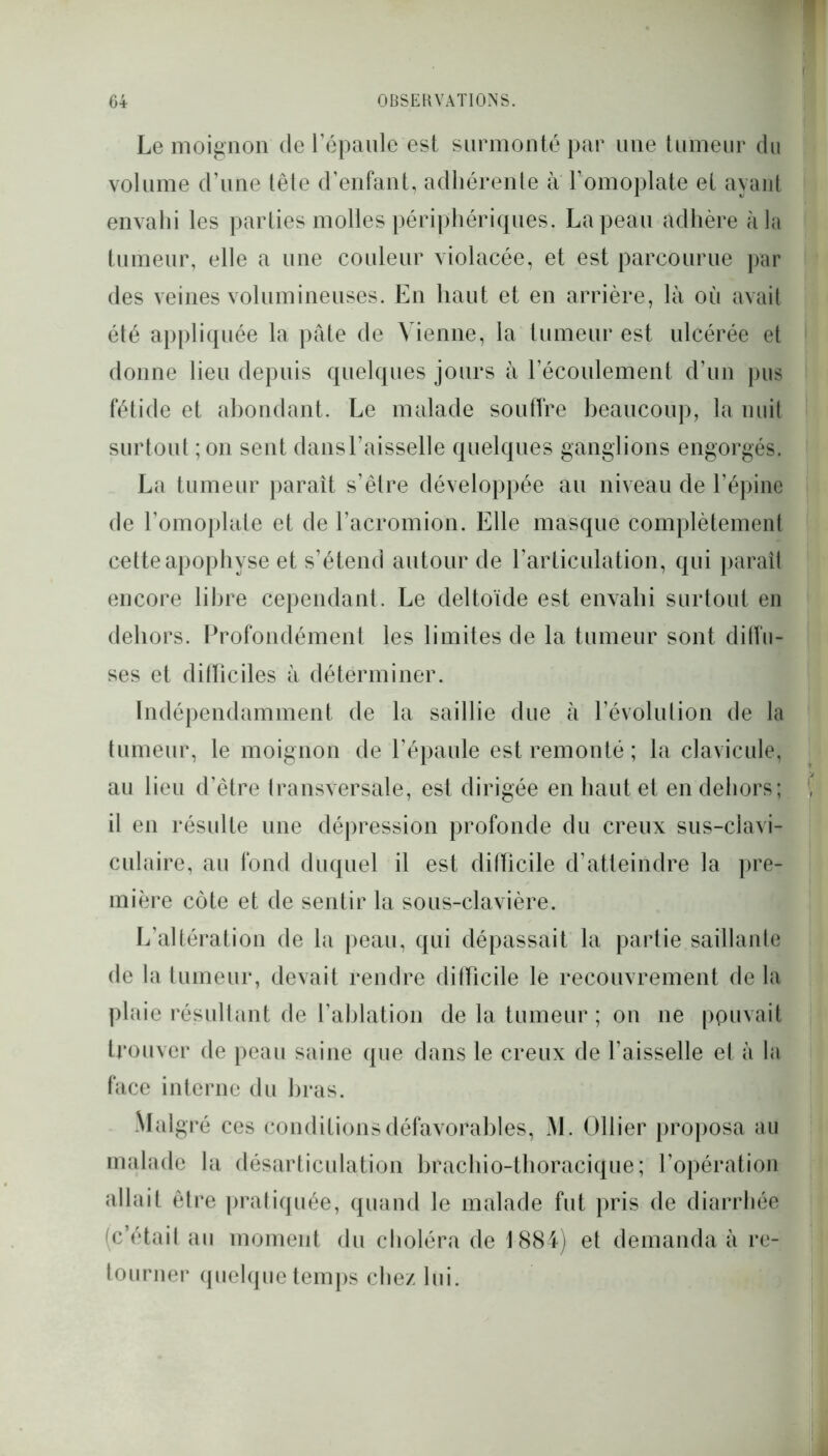 Le moignon de l’épaule est surmonté par une tumeur du volume d’une tête d’enfant, adhérente à l’omoplate et ayant envahi les parties molles périphériques. La peau adhère à la tumeur, elle a une couleur violacée, et est parcourue par des veines volumineuses. En haut et en arrière, là où avait été appliquée la pâte de Vienne, la tumeur est ulcérée et donne lieu depuis quelques jours à l’écoulement d’un pus fétide et abondant. Le malade souffre beaucoup, la nuit surtout ; on sent dans l’aisselle quelques ganglions engorgés. La tumeur paraît s’être développée au niveau de l’épine de l’omoplate et de l’acromion. Elle masque complètement cette apophyse et s’étend autour de l’articulation, qui paraît encore libre cependant. Le deltoïde est envahi surtout en dehors. Profondément les limites de la tumeur sont diffu- ses et difficiles à déterminer. Indépendamment de la saillie due à l’évolution de la tumeur, le moignon de l’épaule est remonté ; la clavicule, au lieu d’être transversale, est dirigée en haut et en dehors; il en résulte une dépression profonde du creux sus-clavi- culaire, au fond duquel il est difficile d’atteindre la pre- mière côte et de sentir la sous-clavière. L’altération de la peau, qui dépassait la partie saillante de la tumeur, devait rendre difficile le recouvrement de la plaie résultant de l’ablation de la tumeur; on ne pouvait trouver de peau saine que dans le creux de faisselle et à la face interne du bras. Malgré ces conditions défavorables, M. Ollier proposa au malade la désarticulation brachio-thoracique; l’opération allait être pratiquée, quand le malade fut pris de diarrhée (c’était au moment du choléra de 1884) et demanda à re- tourner quelque temps chez lui.