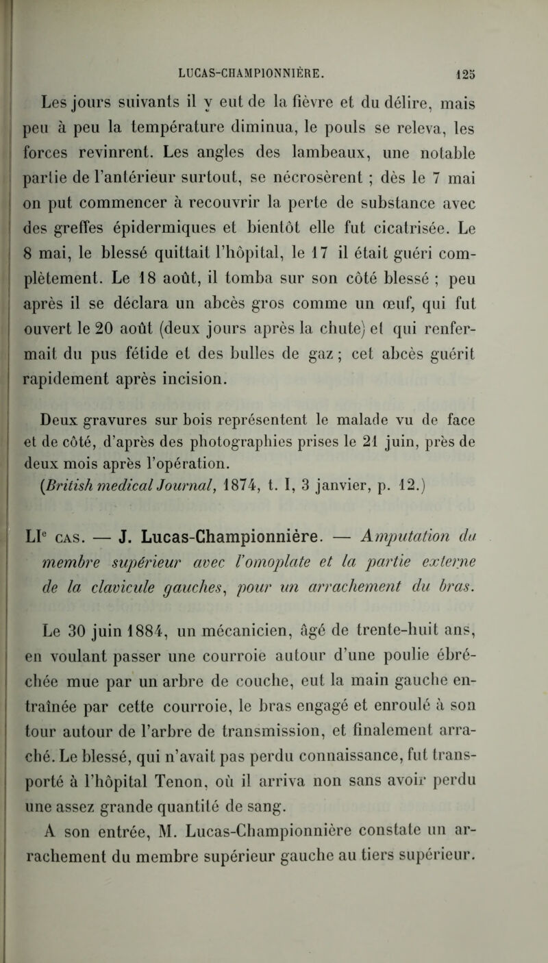 Les jours suivants il y eut de la fièvre et du délire, mais peu à peu la température diminua, le pouls se releva, les forces revinrent. Les angles des lambeaux, une notable partie de l’antérieur surtout, se nécrosèrent ; dès le 7 mai on put commencer à recouvrir la perte de substance avec des greffes épidermiques et bientôt elle fut cicatrisée. Le 8 mai, le blessé quittait l’hôpital, le 17 il était guéri com- plètement. Le 18 août, il tomba sur son côté blessé ; peu après il se déclara un abcès gros comme un œuf, qui fut ouvert le 20 août (deux jours après la chute) et qui renfer- mait du pus fétide et des bulles de gaz; cet abcès guérit rapidement après incision. Deux gravures sur bois représentent le malade vu de face et de côté, d’après des photographies prises le 21 juin, près de deux mois après l’opération. (British medical Journal, 1874, t. I, 3 janvier, p. 12.) LP cas. — J. Lucas-Championnière. — Amputation du membre supérieur avec Vomoplate et la partie externe de la clavicule gauches, pour un arrachement du bras. Le 30 juin 1884, un mécanicien, âgé de trente-huit ans, en voulant passer une courroie autour d’une poulie ébré- chée mue par un arbre de couche, eut la main gauche en- traînée par cette courroie, le bras engagé et enroulé à son tour autour de l’arbre de transmission, et finalement arra- ché. Le blessé, qui n’avait pas perdu connaissance, fut trans- porté à l’hôpital Tenon, où il arriva non sans avoir perdu une assez grande quantité de sang. A son entrée, M. Lucas-Championnière constate un ar- rachement du membre supérieur gauche au tiers supérieur.