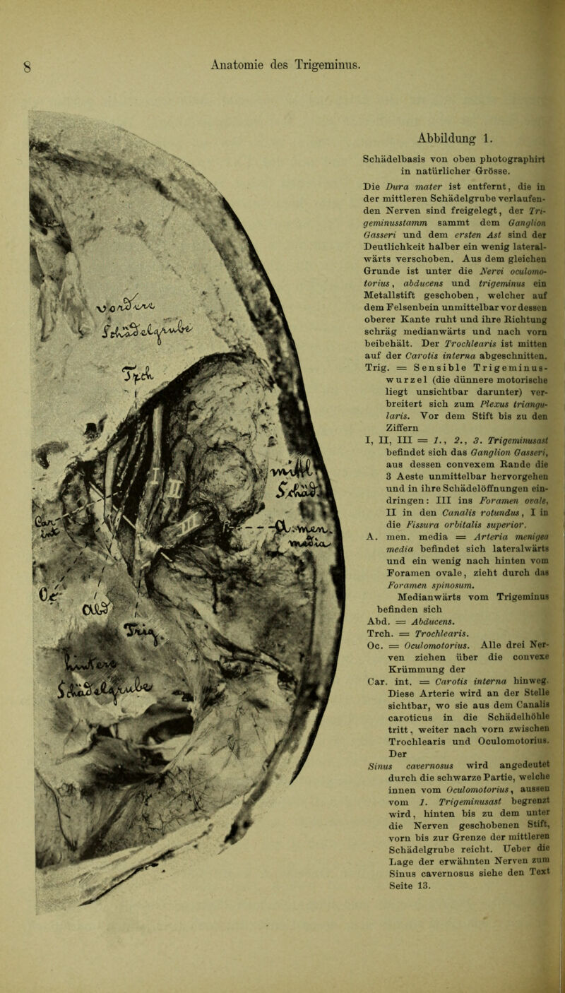 Abbildung 1. Schâdelbasis von oben photographirt in natürlicber Grôsse. Die Dura mater ist entfernt, die in der mittleren Schâdelgrube verlaufen- den Nerven sind freigelegt, der Tri- geminusstamm sammt dem Ganglion Gasseri und dem ersten Ast sind der Deutlicbkeit balber ein wenig lateral- wârts verschoben. Aus dem gleicben Grande ist unter die Nervi oculomo- torius, abducens und trigeminus ein Metallstift geschoben, welcher auf dem Felsenbein unmittelbar vor dessen obérer Xante ruht und ihre Kichtung schràg medianwârts und nacb vorn beibehàlt. Der Trochlearis ist mitten auf der Carotis interna abgeschnitten. Trig. = Sensible Trigeminus- w u r z e 1 (die dünnere motoriscbe liegt unsicbtbar darunter) ver- breitert sicb zum Plexus triangu- laris. Vor dem Stift bis zu den Ziffern I, II, III = J., 2., 3. Trigeminusast befindet sich das Ganglion Gasseri, aus dessen convexem Bande die 3 Aeste unmittelbar bervorgehen und in ibre Scbâdelôffnungen ein- dringen: III ins Foramen ovale, II in den Canalis rotundus, I in die Fissura orbitalis superior. A. men. media = Arteria menigea media befindet sich lateralwàrts und ein wenig nacb hinten vom Foramen ovale, zieht durch das Foramen spinosum. Medianwàrts vom Trigeminus befinden sich Abd. == Abducens. Trch. = Trochlearis. Oc. = Oculomotorius. Aile drei Ner- ven zieben über die convexe Krümmung der Car. int. = Carotis interna hinweg. Diese Arterie wird an der Stelle sichtbar, wo sie aus dem Canalis caroticus in die SchàdelhÛhle tritt, weiter nach vorn zwischen Trochlearis und Oculomotorius. Der Sinus cavernosus wird angedeutet durch die scbwarze Partie, welche innen vom Oculomotorius, aussen vom 1. Trigeminusast begrenzt wird, hinten bis zu dem unter die Nerven gescbobenen Stift, vorn bis zur Grenze der mittleren Schâdelgrube reicbt. Ueber die Lage der erwàbnten Nerven zum Sinus cavernosus siehe den Text Seite 13.