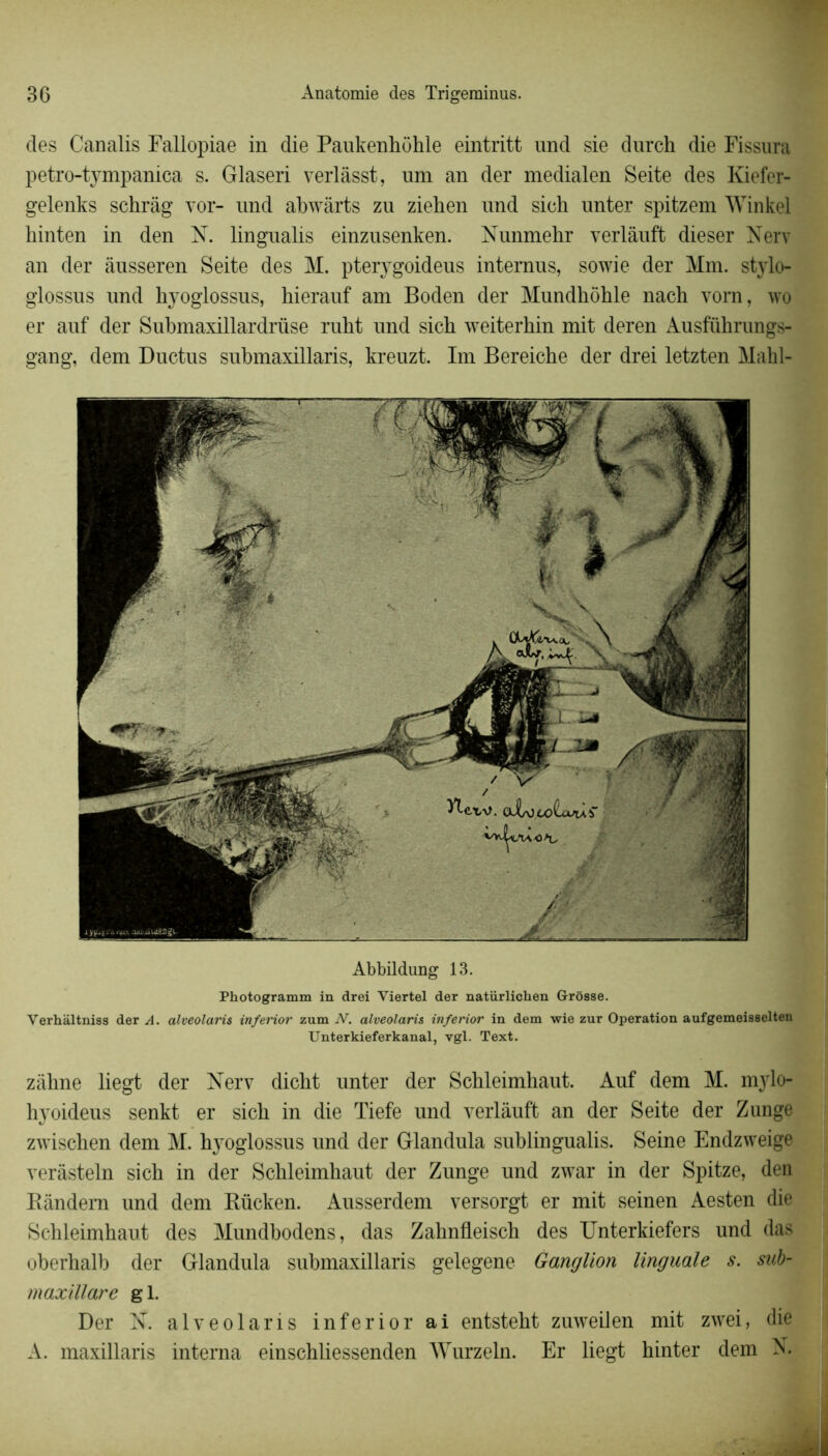 des Canalis Fallopiae in die Paukenhohle eintritt und sie durch die Fissura petro-tympanica s. Glaseri verlâsst, um an der medialen Seite des Kiefer- gelenks schrâg vor- und abwàrts zu ziehen und sieh unter spitzem Winkel hinten in den N. lingualis einzusenken. Nunmehr verlâuft dieser Nerv an der âusseren Seite des M. pterygoideus intemus, sowie der Mm. stylo- glossus und hyoglossus, hierauf am Boden der Mundhôhle nach vorn, wo er auf der Submaxillardrüse ruht und sich weiterhin mit deren Ausfuhrungs- gang, dem Ductus submaxillaris, kreuzt. Im Bereiche der drei letzten Mahl- Abbildung 13. Photogramm in drei Yiertel der natürlichen Grosse. Verhàltniss der A. alveolaris inferior zum N. alveolaris inferior in dem wie zur Operation aufgemeisselten Unterkieferkanal, vgl. Text. zàhne liegt der Nerv dicbt unter der Schleimhaut. Auf dem M. mylo- hyoideus senkt er sich in die Tiefe und verlâuft an der Seite der Zunge zwischen dem M. hyoglossus und der Glandula sublingualis. Seine Endzweige verâsteln sich in der Schleimhaut der Zunge und zwar in der Spitze, den Rândera und dem Rücken. Ausserdem versorgt er mit seinen Aesten die Schleimhaut des Mundbodens, das Zahnfleisch des Unterkiefers und das oberhalb der Glandula submaxillaris gelegene Ganglion linguale s. sub- maxillare gl. Der N. alveolaris inferior ai entsteht zuweilen mit zwei, die A. maxillaris interna einschliessenden Wurzeln. Er liegt hinter dem N.