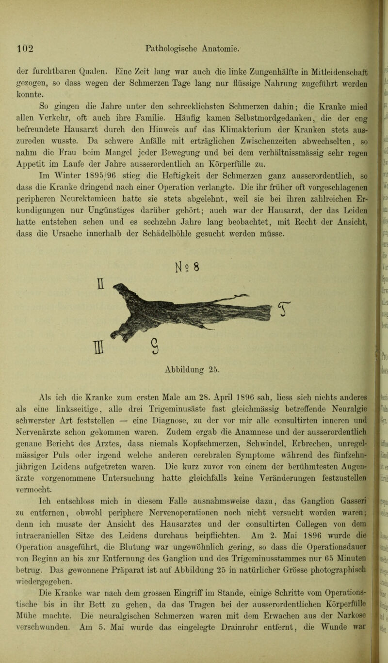 der furcbtbaren Qualen. Eine Zeit lang war auch die linke Zungenhâlfte in Mitleidenscbaft gezogen, so dass wegen der Scbmerzen Tage lang nur flüssige Nabrung zugefübrt werden konnte. So gingen die Jabre unter den scbrecklicbsten Scbmerzen dabin; die Kranke mied allen Yerkebr, oft aucb ibre Familie. Hâufig kamen Selbstmordgedanken, die der eng befreundete Hausarzt durcb den Hinweis anf das Klimakterium der Kranken stets aus- zureden wusste. Da scbwere Anfâlle mit ertrâglicben Zwiscbenzeiten abwecbselten, so nabm die Frau beim Mangel jeder Bewegung und bei dem verbâltnissmâssig sebr regen Appétit im Laufe der Jabre ausserordentlicb an Kôrperfülle zu. Im Winter 1895/96 stieg die Heftigkeit der Scbmerzen ganz ausserordentlicb, so dass die Kranke dringend nacb einer Operation verlangte. Die ibr friiber oft vorgescblagenen peripberen Neurektomieen batte sie stets abgelebnt, weil sie bei ibren zablreicben Er- kundigungen nur Ungünstiges darüber gebort; aucb war der Hausarzt, der das Leiden batte entstehen seben und es secbzebn Jabre lang beobacbtet, mit Recbt der Ansicbt, dass die Ursacbe innerbalb der Scbâdelbôble gesucbt werden rnüsse. Abbildung 25. Als icb die Kranke zum ersten Male am 28. April 1896 sab, liess sicb nicbts anderes als eine linksseitige, aile drei Trigeminusàste fast gleicbmàssig betreffende Neuralgie scbwerster Art feststellen — eine Diagnose, zu der vor mir aile consultirten inneren und Nervenârzte scbon gekommen waren. Zudem ergab die Anamnese und der ausserordentlich genaue Bericbt des Arztes, dass niemals Kopfscbmerzen, Scbwindel, Erbrecben, unregel- mâssiger Puis oder irgend welcbe anderen cerebralen Symptôme wâbrend des fiinfzebn- jàhrigen Leidens aufgetreten waren. Die kurz zuvor von einem der berübmtesten Augen- ârzte vorgenommene Untersucbung batte gleicbfalls keine Yerànderungen festzustellen vermocbt. Icb entscbloss micb in diesem Falle ausnahmsweise dazu, das Ganglion Gasseri zu entfernen, obwobl peripbere Nervenoperationen nocb nicbt versucbt worden waren; denn icb musste der Ansicbt des Hausarztes und der consultirten Collegen von dem intracraniellen Sitze des Leidens durchaus beipflicbten. Am 2. Mai 1896 wurde die Operation ausgefübrt, die Blutung war ungewobnlicb gering, so dass die Operationsdauer von Beginn an bis zur Entfernung des Ganglion und des Trigeminusstammes nur 65 Minuten betrug. Das gewonnene Pràparat ist auf Abbildung 25 in natürlicber Grosse pbotographisch wiedergegeben. Die Kranke war nacb dem grossen Eingriff im Stande, einige Scbritte vom Operations- tische bis in ibr Bett zu geben, da das Tragen bei der ausserordentbcben Kërperfülle Mühe macbte. Die neuralgischen Scbmerzen waren mit dem Erwacben aus der Narkose verscbwunden. Am 5. Mai wurde das eingelegte Drainrobr entfemt, die Wunde war