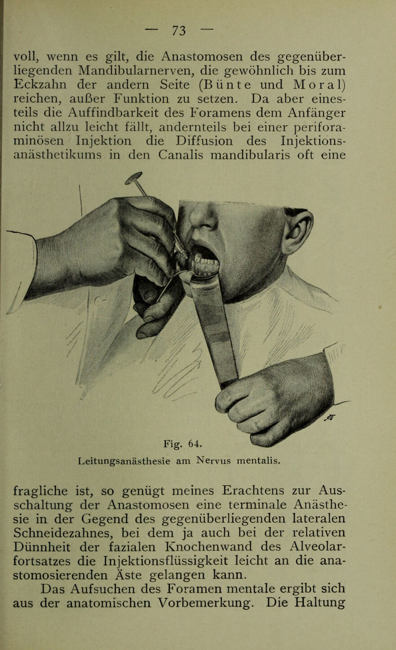 voll, wenn es gilt, die Anastomosen des gegenüber- liegenden Mandibularnerven, die gewöhnlich bis zum Eckzahn der andern Seite (Bünte und Moral) reichen, außer Funktion zu setzen. Da aber eines- teils die Auffindbarkeit des Foramens dem Anfänger nicht allzu leicht fällt, andernteils bei einer perifora- minösen Injektion die Diffusion des Injektions- anästhetikums in den Canalis mandibularis oft eine Leitungsanästhesie am Nervus mentalis. fragliche ist, so genügt meines Erachtens zur Aus- schaltung der Anastomosen eine terminale Anästhe- sie in der Gegend des gegenüberliegenden lateralen Schneidezahnes, bei dem ja auch bei der relativen Dünnheit der fazialen Knochenwand des Alveolar- fortsatzes die Injektionsflüssigkeit leicht an die ana- stomosierenden Äste gelangen kann. Das Aufsuchen des Foramen mentale ergibt sich aus der anatomischen Vorbemerkung. Die Haltung