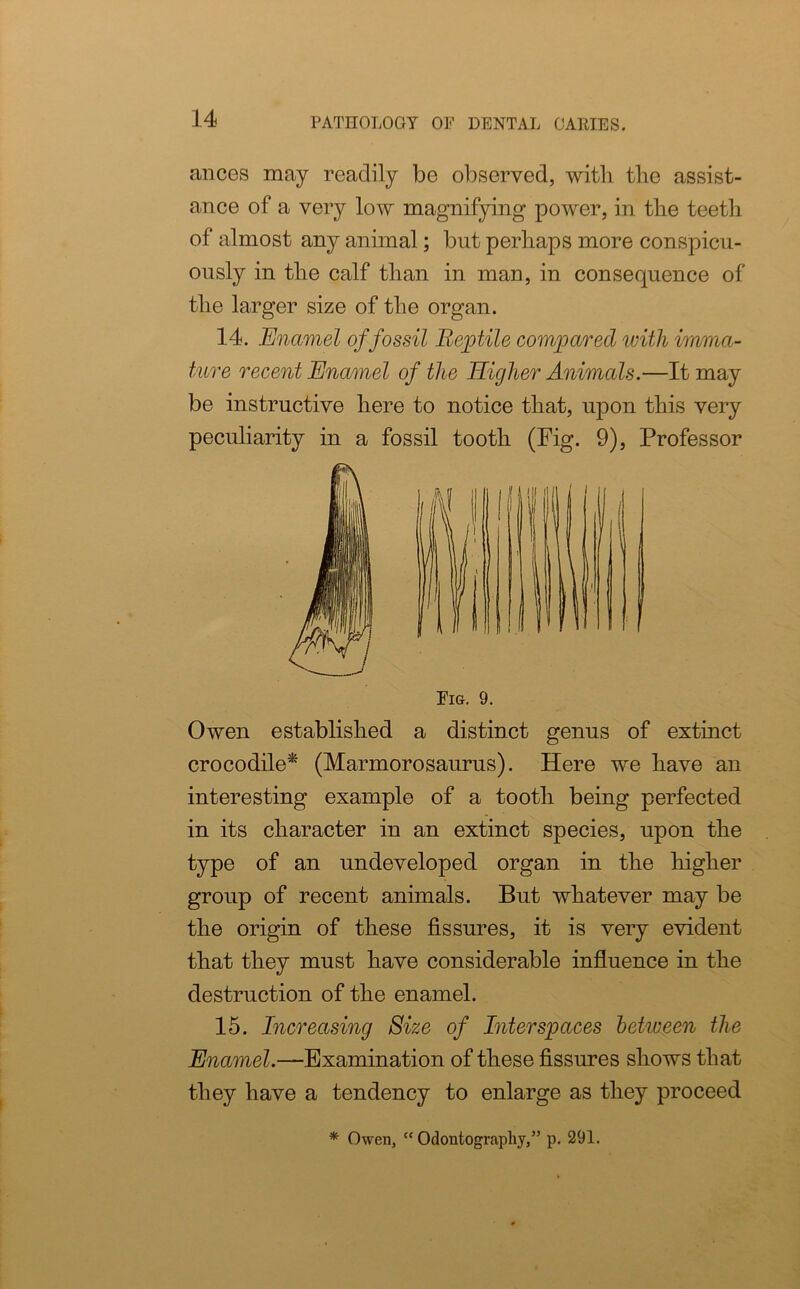ances may readily be observed, with the assist- ance of a very low magnifying power, in the teeth of almost any animal; but perhaps more conspicu- ously in the calf than in man, in consequence of the larger size of the organ. 14. Enamel of fossil Reptile compared with imma- ture recent Enamel of the Higher Animals.—It may be instructive here to notice that, upon this very peculiarity in a fossil tooth (Fig. 9), Professor Fig. 9. Owen established a distinct genus of extinct crocodile* (Marmorosaurus). Here we have an interesting example of a tooth being perfected in its character in an extinct species, upon the type of an undeveloped organ in the higher group of recent animals. But whatever may be the origin of these fissures, it is very evident that they must have considerable influence in the destruction of the enamel. 15. Increasing Size of Interspaces betiveen the Enamel.—Examination of these fissures shows that they have a tendency to enlarge as they proceed * Owen, “ Odontography,” p. 291.