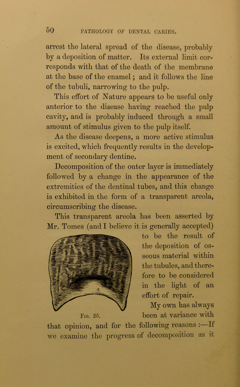 arrest the lateral spread of the disease, probably by a deposition of matter. Its external limit cor- responds with that of the death of the membrane at the base of the enamel; and it follows the line of the tubuli, narrowing to the pulp. This effort of Nature appears to be useful only anterior to the disease having reached the pulp cavity, and is probably induced through a small amount of stimulus given to the pulp itself. As the disease deepens, a more active stimulus is excited, which frequently results in the develop- ment of secondary dentine. Decomposition of the outer layer is immediately followed by a change in the appearance of the extremities of the dentinal tubes, and this change is exhibited in the form of a transparent areola, circumscribing the disease. This transparent areola has been asserted by Mr. Tomes (and I believe it is generally accepted) to be the result of the deposition of os- seous material within the tubules, and there- fore to be considered in the light of an effort of repair. My own has always Fig. 26. been at variance with that opinion, and for the following reasons : If we examine the progress of decomposition as it