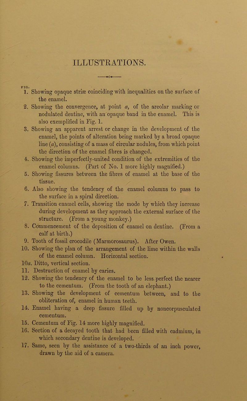 ILLUSTRATIONS. FIG. 1. Showing opaque striae coinciding with inequalities on the surface of the enamel. 2. Showing the convergence, at point «, of the areolar marking or nodulated dentine, with an opaque band in the enamel. This is also exemplified in Fig. 1. 3. Showing an apparent arrest or change in the development of the enamel, the points of alteration being marked by a broad opaque line (a), consisting of a mass of circular nodules, from which point the direction of the enamel fibres is changed. 4. Showing the imperfectly-united condition of the extremities of the enamel columns. (Part of No. 1 more highly magnified.) 5. Showing fissures between the fibres of enamel at the base of the tissue. 6. Also showing the tendency of the enamel columns to pass to the surface in a spiral direction. 7. Transition enamel cells, showing the mode by which they increase during development as they approach the external surface of the structure. (From a young monkey.) 8. Commencement of the deposition of enamel on dentine. (From a calf at birth.) 9. Tooth of fossil crocodile (Marmorosaurus). After Owen. 10. Showing the plan of the arrangement of the lime within the walls of the enamel column. Horizontal section. 10a. Ditto, vertical section. 11. Destruction of enamel by caries. 12. Showing the tendency of the enamel to be less perfect the nearer to the cementum. (From the tooth of an elephant.) 13. Showing the development of cementum between, and to the obliteration of, enamel in human teeth. 14. Enamel having a deep fissure filled up by noncorpusculated cementum. 15. Cementum of Fig. 14 more highly magnified. 16. Section of a decayed tooth that had been filled with cadmium, in which secondary dentine is developed. 17. Same, seen by the assistance of a two-thirds of an inch power, drawn by the aid of a camera.