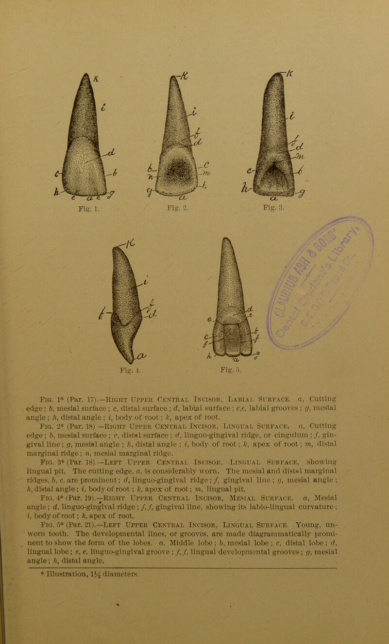 GC Fig. 3. . X' ./ .7 c > <f >t. , // V- Fig. 1* (Par. 17).—Right Upper Central Incisor, Labial Surface, a, Cutting edge; b, mesial surface ; c, distal surface ; d, labial surface; e,e, labial grooves ; g, mesial angle ; h, distal angle ; i, body of root; k, apex of root. Fig. 2* (Par. 18) —Right Upper Central Incisor, Lingual Surface, a, Cutting edge ; b, mesial surface ; c, distal surface ; d, linguo-gingival ridge, or cingulum ; /, gin- gival line; g, mesial angle ; h, distal angle ; i, body of root; k, apex of root; m, distal marginal ridge; n, mesial marginal ridge. Fig. 3* (Par. 18).—Left Upper Central Incisor, Lingual Surface, showing lingual pit. The cutting edge, a, is considerably worn. The mesial and distal marginal ridges, b, c, are prominent; d, linguo-gingival ridge; /, gingival line ; g, mesial angle ; h, distal angle ; i, body of root ; k, apex of root; m, lingual pit. Fig. 4* (Par. 19).—Right Upper Central Incisor, Mesial Surface, a, Mesial angle; d, linguo-gingival ridge ; /,/, gingival line, showing its labio-lingual curvature; i, body of root; k, apex of root. Fig. 5* (Par. 21).—Left Upper Central Incisor, Lingual Surface. Young, un- worn tooth. The developmental lines, or grooves, are made diagrammatically promi- nent to show the form of the lobes, a, Middle lobe ; b, mesial lobe ; c, distal lobe ; d, lingual lobe; e, e, linguo-gingival groove ; /,/, lingual developmental grooves ; g, mesial angle; h, distal angle.