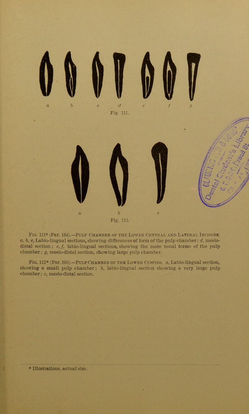 Fig. 112. Fig. ill* (Par. 164).—Pulp Chamber of the Lower Central and Lateral Incisors. a, b, c, Labio-lingual sections, showing differences of form of the pulp chamber; d, mesio- distal section; e, f, labio-lingual sections, showing the more usual forms of the pulp chamber; g, mesio-distal section, showing large pulp chamber. Fig. 112* (Par. 165).—Pulp Chamber of the Lower Cuspids, a, Labio-lingual section, showing a small pulp chamber; b, labio-lingual section showing a very large pulp chamber; c, mesio-distal section.