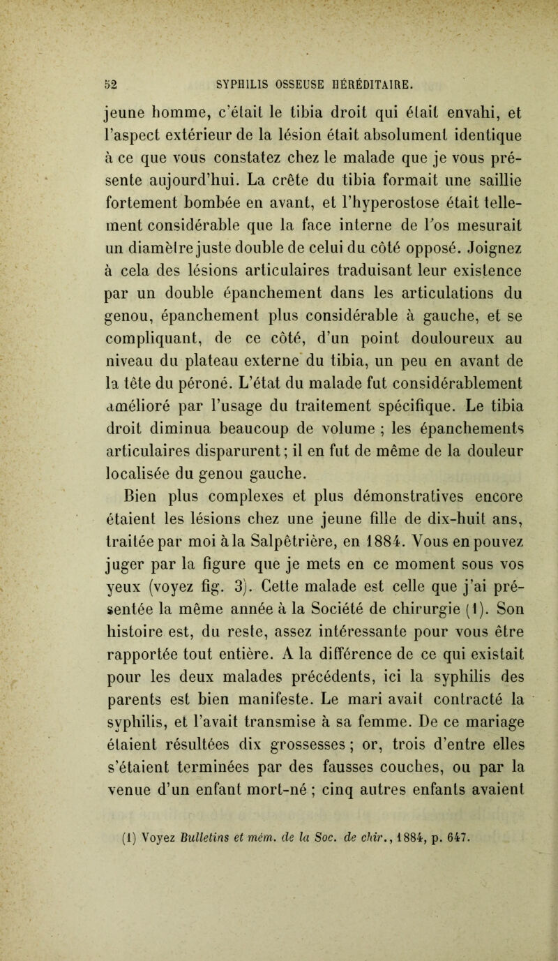 jeune homme, c’était le tibia droit qui était envahi, et l’aspect extérieur de la lésion était absolument identique à ce que vous constatez chez le malade que je vous pré- sente aujourd’hui. La crête du tibia formait une saillie fortement bombée en avant, et l’hyperostose était telle- ment considérable que la face interne de Los mesurait un diamètre juste double de celui du côté opposé. Joignez à cela des lésions articulaires traduisant leur existence par un double épanchement dans les articulations du genou, épanchement plus considérable à gauche, et se compliquant, de ce côté, d’un point douloureux au niveau du plateau externe du tibia, un peu en avant de la tête du péroné. L’état du malade fut considérablement amélioré par l’usage du traitement spécifique. Le tibia droit diminua beaucoup de volume ; les épanchements articulaires disparurent; il en fut de même de la douleur localisée du genou gauche. Bien plus complexes et plus démonstratives encore étaient les lésions chez une jeune fille de dix-huit ans, traitée par moi à la Salpêtrière, en 1884. Vous en pouvez juger par la figure que je mets en ce moment sous vos yeux (voyez fig. 3). Cette malade est celle que j’ai pré- sentée la même année à la Société de chirurgie (1). Son histoire est, du reste, assez intéressante pour vous être rapportée tout entière. A la différence de ce qui existait pour les deux malades précédents, ici la syphilis des parents est bien manifeste. Le mari avait contracté la syphilis, et l’avait transmise à sa femme. De ce mariage étaient résultées dix grossesses ; or, trois d’entre elles s’étaient terminées par des fausses couches, ou par la venue d’un enfant mort-né ; cinq autres enfants avaient (1) Voyez Bulletins et mém. de la Soc. de cltir., 1884, p. 647.