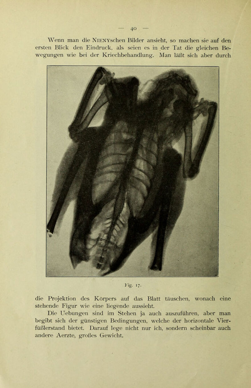 Wenn man die NlENYschen Bilder ansieht, so machen sie auf den ersten Blick den Eindruck, als seien es in der Tat die gleichen Be- wegungen wie bei der Kriechbehandlung. Man läßt sich aber durch Eig. 17. die Projektion des Körpers auf das Blatt täuschen, wonach eine stehende Figur wie eine liegende aussieht. Die Uebungen sind im Stehen ja auch auszuführen, aber man begibt sich der günstigen Bedingungen, welche der horizontale Vier- füßlerstand bietet. Darauf lege nicht nur ich, sondern scheinbar auch andere Aerzte, großes Gewicht.