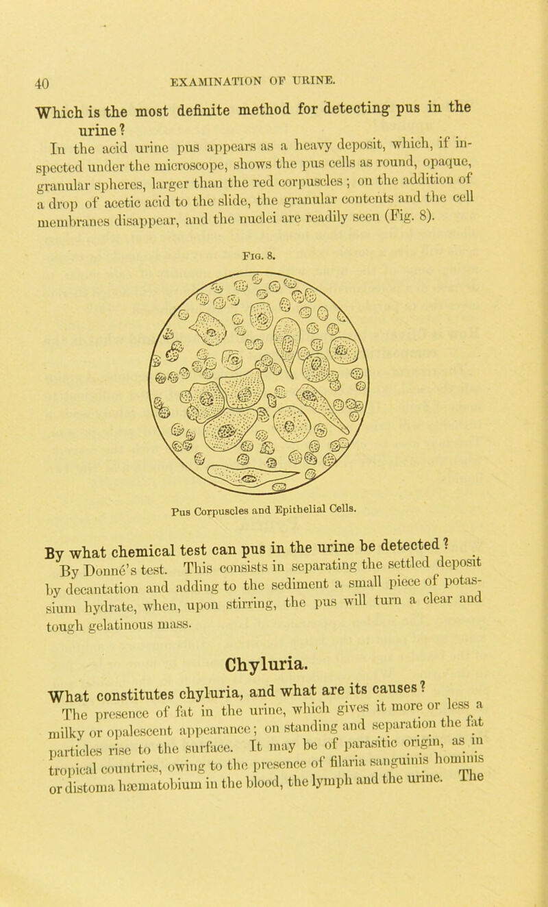 Which is the most definite method for detecting pus in the urine ? In the acid urine pus appears as a heavy deposit, which, if in- spected under the microscope, shows the pus cells as round, opaque, granular spheres, larger than the red corpuscles ; on the addition of a drop of acetic acid to the slide, the granular contents and the cell membranes disappear, and the nuclei are readily seen (Fig. 8). Fig. 8. Pus Corpuscles and Epithelial Cells. By what chemical test can pus in the urine he detected ? By Donne’s test. This consists in separating the settled deposit by decantation and adding to the sediment a small piece of potas- sium hydrate, when, upon stirring, the pus will turn a clear and tough gelatinous mass. Chyluria. What constitutes chyluria, and what are its causes? The presence of fat in the urine, which gives it more or less a milky or opalescent appearance; on standing and separation the tat particles rise to the surface. It may be of parasitic origin, as m tropical countries, owing to the presence of filana sanguinis hominis or distoma haematobium in the blood, the lymph and the mine.