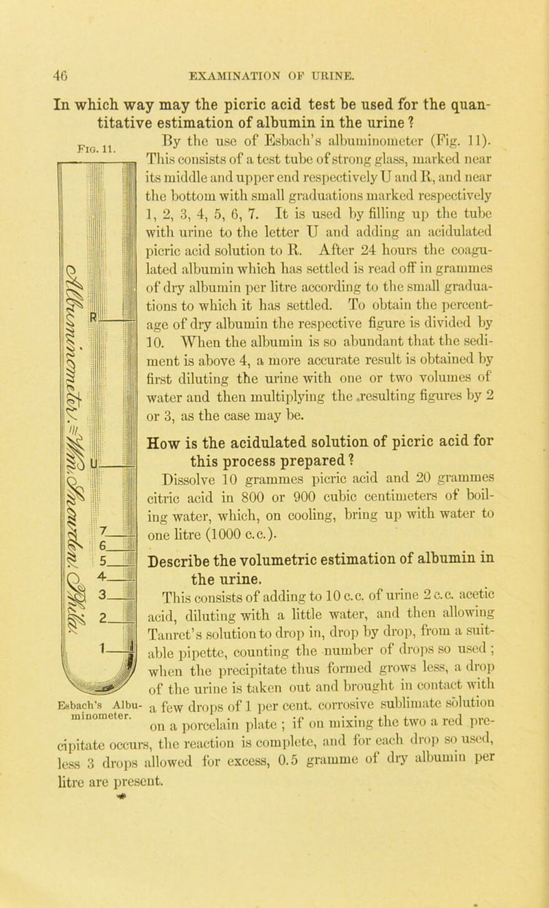 R- 1- In which way may the picric acid test be used for the quan- titative estimation of albumin in the urine ? Fig n f>y the use of Esbach’s albuminouieter (Fig. 11). This consists of a test tube of strong glass, marked near its middle and upper end respectively U and R, and near the bottom with small graduations marked respectively 1, 2, 3, 4, 5, 6, 7. It is used by filling up the tube with urine to the letter U and adding an acidulated picric acid solution to R. After 24 hours the coagu- 0 lated albumin which has settled is read off in grammes 2^ ■ ill of dry albumin per litre according to the small gradua- tions to which it has settled. To obtain the percent- age of dry albumin the respective figure is divided by 10. When the albumin is so abundant that the sedi- ment is above 4, a more accurate result is obtained by first diluting the urine with one or two volumes of' water and then multiplying the ..resulting figures by 2 or 3, as the case may be. How is the acidulated solution of picric acid for this process prepared? O ip; I Dissolve 10 grammes picric acid and 20 grammes ill I citric acid in 800 or 900 cubic centimeters of boil- ing water, which, on cooling, bring up with water to one litre (1000 c.c.). Describe the volumetric estimation of albumin in the urine. This consists of adding to 10 c.c. of urine 2 c.c. acetic acid, diluting with a little water, and then allowing Tanret’s solution to drop in, drop by drop, from a suit- able pipette, counting the number of drops so used ; when the precipitate thus formed grows less, a drop of the urine is taken out and brought in contact with a few drops of 1 per cent, corrosive sublimate solution on a porcelain plate ; if on mixing the two a led pic- cipitate occurs, the reaction is complete, and for each drop so used, less 3 drops allowed for excess, 0.5 gramme of dry albumin per litre are present. Esbach’s Albu- minometer.