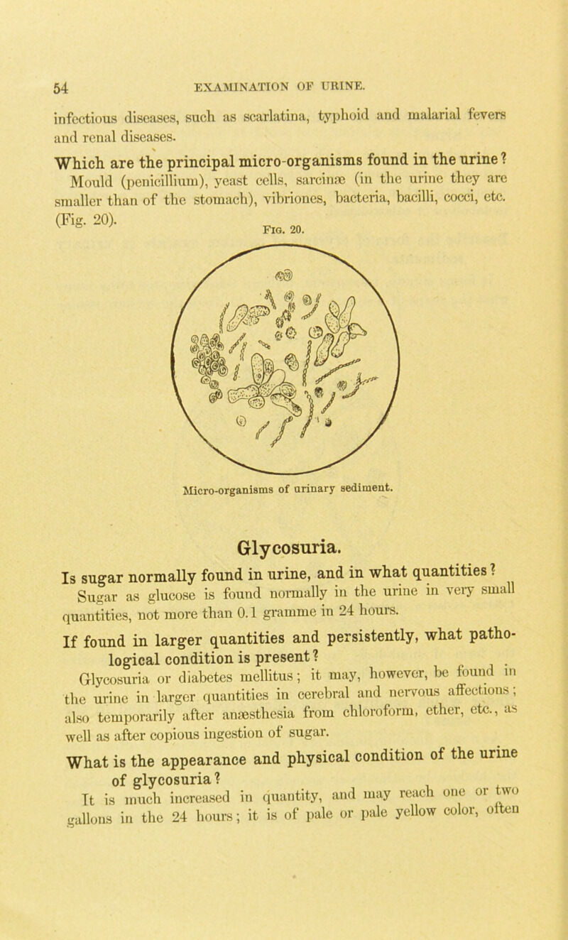 infectious diseases, such as scarlatina, typhoid and malarial fevers and renal diseases. Which are the principal micro-organisms found in the urine ? Mould (penicillium), yeast cells, sarcinae (in the urine they are smaller than of the stomach), vibriones, bacteria, bacilli, cocci, etc. (Fig. 20). v ° Fig. 20. Micro-organisms of urinary sediment. Glycosuria. Is sugar normally found in urine, and in what quantities? Sugar as glucose is found normally in the urine in very small quantities, not more than 0.1 gramme in 24 hours. If found in larger quantities and persistently, what patho- logical condition is present? Glycosuria or diabetes mellitus; it may, however, be found in the urine in larger quantities in cerebral and nervous affections; also temporarily after anesthesia from chloroform, ether, etc., as well as after copious ingestion ot sugar. What is the appearance and physical condition of the urine of glycosuria? It is much increased in quantity, and may reach one or two gallons in the 24 hours; it is of pale or pale yellow color, often