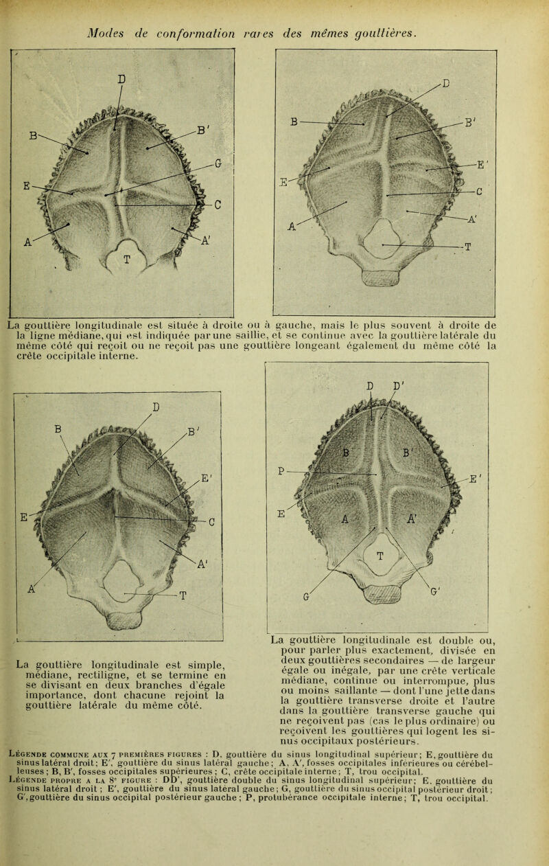 Modes de conformation rares des mêmes gouttières. La gouttière longitudinale est située à droite ou à gauche, mais le plus souvent à droite de la ligne médiane, qui est indiquée par une saillie, et se continue avec la gouttière latérale du même côté qui reçoit ou ne reçoit pas une gouttière longeant également du même côté la crête occipitale interne. La gouttière longitudinale est simple, médiane, rectiligne, et se termine en se divisant en deux branches d’égale importance, dont chacune rejoint la gouttière latérale du même côté. La gouttière longitudinale est double ou, pour parler plus exactement, divisée en deux gouttières secondaires — de largeur égale ou inégale, par une crête verticale médiane, continue ou interrompue, plus ou moins saillante — dont l’une Jette dans la gouttière transverse droite et l’autre dans la gouttière transverse gauche qui ne reçoivent pas (cas le plus ordinaire) ou reçoivent les gouttières qui logent les si- nus occipitaux postérieurs. Légende commune aux 7 premières figures : D, gouttière du sinus longitudinal supérieur; E, gouttière du sinus latéral droit; E', gouttière du sinus latéral gauche; A, A', fosses occipitales inférieures ou cérébel- leuses ; B, B', fosses occipitales supérieures ; C, crête occipitale interne ; T, trou occipital. Légende propre a la 8* figure : DD’, gouttière double du sinus longitudinal supérieur; E. gouttière du sinus latéral droit ; E', gouttière du sinus latéral gauche; G, gouttière du sinus occipital postérieur droit; G',gouttière du sinus occipital postérieur gauche ; P, protubérance occipitale interne; T, trou occipital.