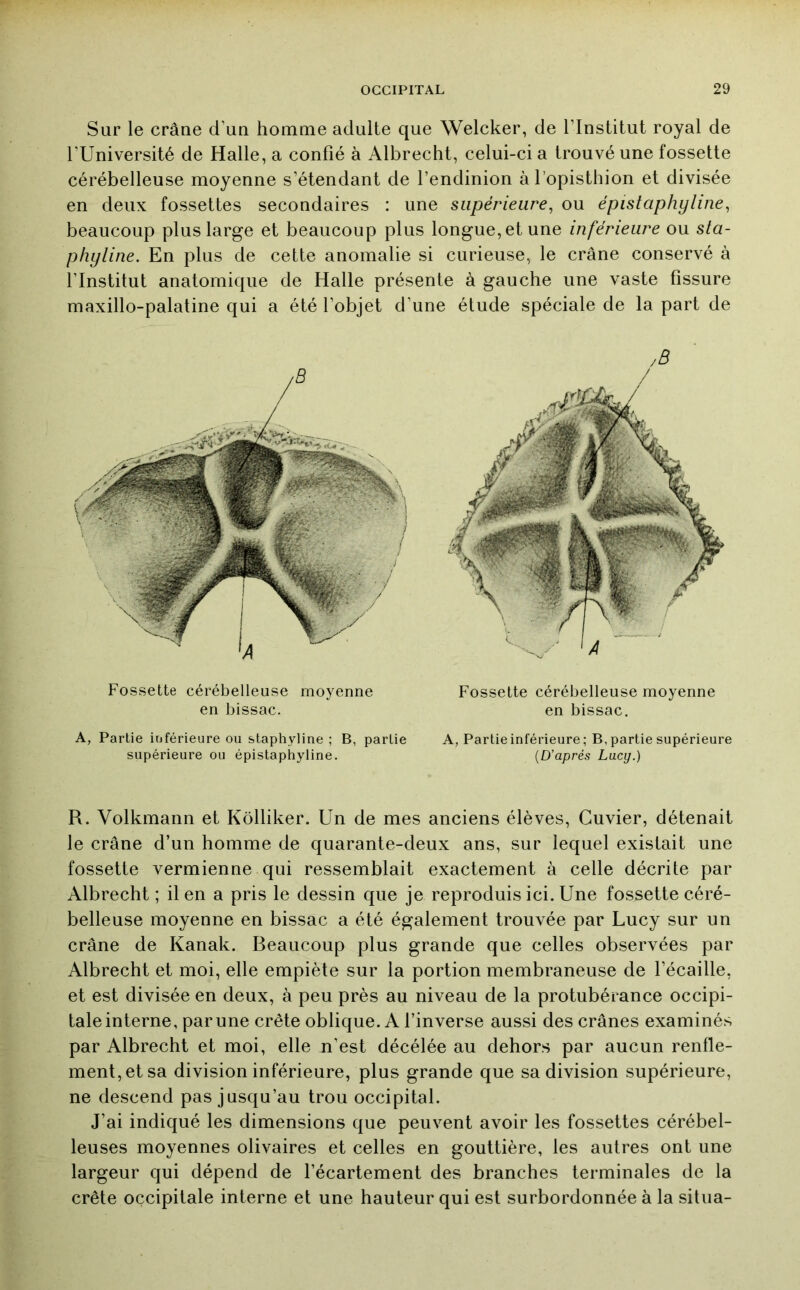 Sur le crâne d’uu homme adulte que Welcker, de l’Institut royal de l’Université de Halle, a confié à Albrecht, celui-ci a trouvé une fossette cérébelleuse moyenne s’étendant de l’endinion àl’opisthion et divisée en deux fossettes secondaires : une supérieure, ou épistaphyline, beaucoup plus large et beaucoup plus longue, et une inférieure ou sta- phyline. En plus de cette anomalie si curieuse, le crâne conservé à l’Institut anatomique de Halle présente à gauche une vaste fissure maxillo-palatine qui a été l’objet d’une étude spéciale de la part de Fossette cérébelleuse moyenne en bissac. Fossette cérébelleuse moyenne en bissac. A, Partie inférieure ou staphyline ; B, partie supérieure ou épistaphyline. A, Partie inférieure ; B, partie supérieure {D’après Lucij.) R. Volkmann et Kôlliker. Un de mes anciens élèves. Cuvier, détenait le crâne d’un homme de quarante-deux ans, sur lequel existait une fossette vermienne qui ressemblait exactement à celle décrite par Albrecht ; il en a pris le dessin que je reproduis ici. Une fossette céré- belleuse moyenne en bissac a été également trouvée par Lucy sur un crâne de Kanak. Beaucoup plus grande que celles observées par Albrecht et moi, elle empiète sur la portion membraneuse de l’écaille, et est divisée en deux, à peu près au niveau de la protubérance occipi- tale interne, par une crête oblique. A l’inverse aussi des crânes examinés par Albrecht et moi, elle n’est décélée au dehors par aucun renfle- ment, et sa division inférieure, plus grande que sa division supérieure, ne descend pas jusqu’au trou occipital. J’ai indiqué les dimensions que peuvent avoir les fossettes cérébel- leuses moyennes olivaires et celles en gouttière, les autres ont une largeur qui dépend de l’écartement des branches terminales de la crête occipitale interne et une hauteur qui est surbordonnée à la situa-