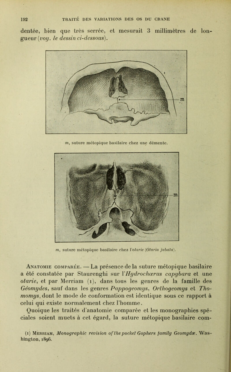 dentée, bien que très serrée, et mesurait 3 millimètres de lon- gueur (uoi/. le dessin ci-dessous). m, suture métopique basilaire chez Volarie {Olaria jubala). Anatomie comparée. — La présence de la suture métopique basilaire a été constatée par Staurenghi sur VHydrochœriis capybara et une otarie^ et par Merriam (i), dans tous les genres de la famille des Géomydes, sauf dans les genres Pappoyeomys, Orlhogeomys et Tho- momys, dont le mode de conformation est identique sous ce rapport à celui qui existe normalement chez l’homme. Quoique les traités d’anatomie comparée et les monographies spé- ciales soient muets à cet égard, la suture métopique basilaire com- (i) Merriam, Monographie révision ofthepocket Gophers family Geomydæ. Was- hington, 1896.