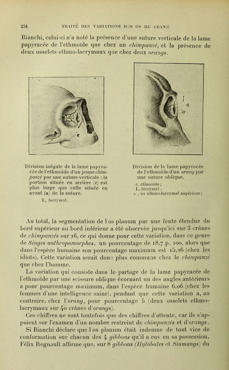 Blanchi, celui-ci n’a noté la présence d'une suture verticale de la lame papyracée de l’ethmoïde que chez un chimpanzé, et la présence de deux osselets ethmo-lacrymaux que chez deux orangs. Division inégale de la lame papyra- cée de l’ethmoïde d’un jeune chim- panzé par une suture verticale : la portion située en arrière (e) est plus large que celle située en avant (a) de la suture. L, lacrymal. Division de la lame papyracée de l'ethmoïde d’un orang par une suture oblique. e, ethmoïde ; L, lacrymal ; a , os ethmo-lacrymal supérieur; Au total, la seg-mentation de 1 os planum par une fente étendue du bord supérieur au bord inférieur a été observée jusqu’ici sur 3 crânes de chimpanzés sur i6, ce qui donne pour cette variation, dans ce genre de Singes anthropomorphes, un pourcentage de 18,7 p. 100, alors que dans l’espèce humaine son pourcentage maximum est i5,2G (chez les idiots). Cette variation serait donc plus commune chez le chimpanzé que chez l’homme. La variation qui consiste dans le partage de la lame papyracée de l’ethmoïde par une scissure oblique écornant un des angles antérieurs a pour pourcentage maximum, dans l’espèce humaine 6,06 (chez les femmes d’une intelligence saine), pendant que cette variation a, au contraire, chez Vorang, pour pourcentage 5 (deux osselets ethmo- lacrymaux sur 4o crânes (ïorangs). Ces chiffres ne sont toutefois que des chiffres d'attente, car ils s’ap- puient sur l’examen d'un nombre restreint de chimpanzés et iïorangs. Si Bianchi déclare que l os planum était indemne de tout vice de conformation sur chacun des 4 gibbons qu’il a eus en sa possession, Félix Begnault affirme que, sur 8 gibbons (Hglobales et Siamangs) du