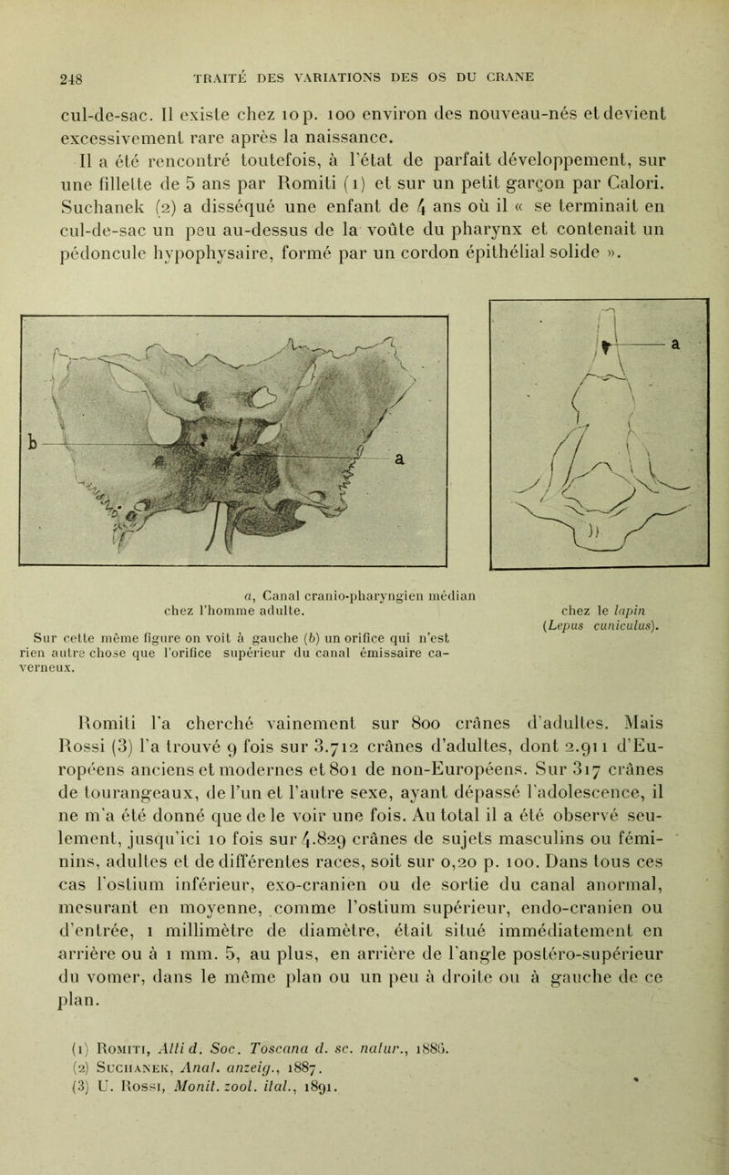 cul-de-sac. Il existe chez lop. loo environ des nouveau-nés et devient excessivement rare après la naissance. Il a été rencontré toutefois, à l’état de parfait développement, sur une fillelte de 5 ans par Romiti (i) et sur un petit garçon par Calori. Suchanek (2) a disséqué une enfant de 4 ans où il « se terminait en cul-de-sac un peu au-dessus de la voûte du pharynx et contenait un pédoncule hypophysaire, formé par un cordon épithélial solide ». a, Canal cranio-pharyngien médian chez l’homme adulte. chez le lapin {Lepas CLiniculus). Sur cette même figure on voit à gauche (6) un orifice qui n’est rien autre chose que l’orifice supérieur du canal émissaire ca- verneux. Romiti l'a cherché vainement sur 800 crânes d’adultes. Mais Rossi (3) l’a trouvé 9 fois sur 8.712 crânes d’adultes, dont 2.911 d’Eu- ropéens anciens et modernes et 801 de non-Européens. Sur 817 crânes de tourangeaux, de Tun et l’autre sexe, ayant dépassé l’adolescence, il ne m'a été donné que de le voir une fois. Au total il a été observé seu- lement, jusqu’ici 10 fois sur 4*^29 crânes de sujets masculins ou fémi- nins, adultes et de différentes races, soit sur 0,20 p. 100. Dans tous ces cas l’ostium inférieur, exo-cranien ou de sortie du canal anormal, mesurant en moyenne, comme l’ostium supérieur, endo-cranien ou d’entrée, 1 millimètre de diamètre, était situé immédiatement en arrière ou à 1 mm. .5, au plus, en arrière de l’angle postéro-supérieur du vomer, dans le même plan ou un peu à droite ou à gauche de ce plan. (1) Romiti, Allid. Soc. Toscana cl. sc. natiir., 188G. (2) Suchanek, Anal, anzeig., 1887. {3) U. Rossi, Monit. zool. liai.., 1891.