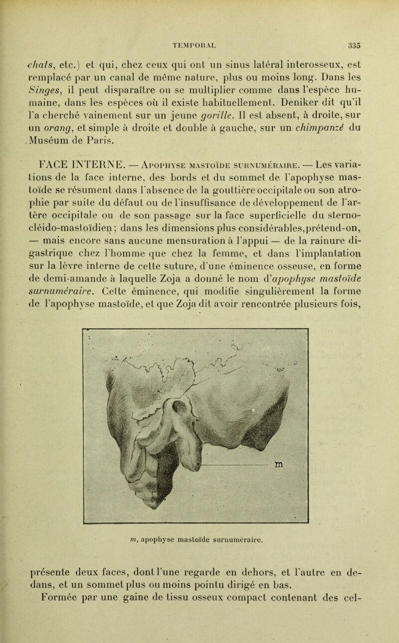 i'hals^ etc.) et qui, chez ceux qui ont un sinus latéral interosseux, est remplacé par un canal de même nature, plus ou moins long. Dans les Singes, il peut disparaître ou se multiplier comme dans l’espèce hu- maine, dans les espèces où il existe habituellement. Deniker dit qu’il l'a cherché vainement sur un jeune gorille. Il est absent, à droite, sur un orang, et simple à droite et double à gauche, sur un chimpanzé du . Muséum de Paris. FACE INTERNE. —Apophyse mastoïde surnuméraire. — Les varia- tions de la face interne, des bords et du sommet de l’apophyse mas- toïde se résument dans l’absence de la gouttière occipitale ou son atro- phie par suite du défaut ou de l’insuffisance de développement de l’ar- tère occipitale ou de son passage sur la face superficielle du sterno- cléido-mastoïdien ; dans les dimensions plus considérables,prétend-on, — mais encore sans aucune mensuration à l’appui — de la rainure di- gastrique chez l’homme que chez la femme, et dans l’implantation sur la lèvre interne de cette suture, d’une éminence osseuse, en forme de demi-amande à laquelle Zoja a donné le nom à'apophgse mastoïde surnuméraire. Cette éminence, qui modifie singulièrement la forme de l’apophyse mastoïde, et que Zoja dit avoir rencontrée plusieurs fois, m, apophyse mastoïde surnuméraire. présente deux faces, dont l’une regarde en dehors, et l’autre en de- dans, et un sommet plus ou moins pointu dirigé en bas. Formée par une gaine de tissu osseux compact contenant des cel-