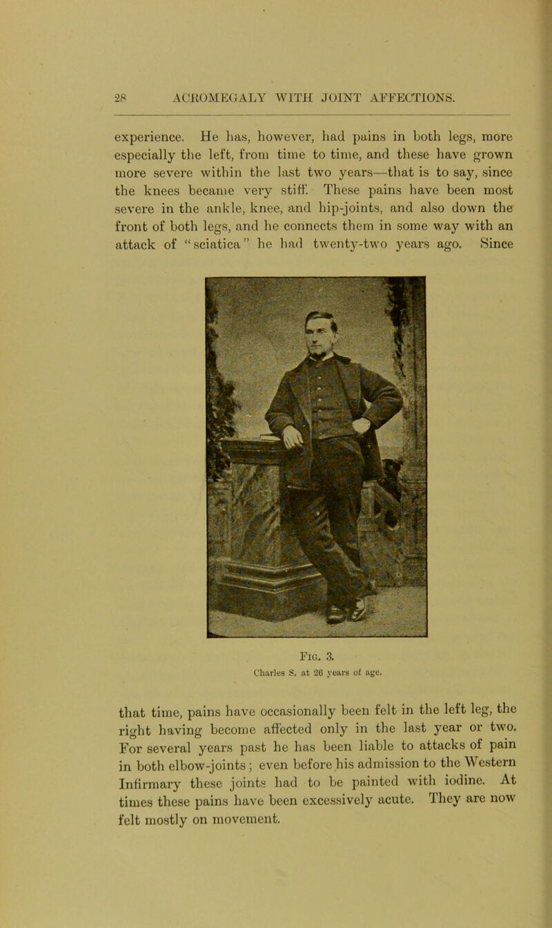 experience. He 1ms, however, had pains in both legs, more especially the left, from time to time, and these have grown more severe within the last two years—that is to say, since the knees became very stiff. These pains have been most severe in the ankle, knee, and hip-joints, and also down the front of both legs, and he connects them in some way with an attack of “sciatica” he had twenty-two years ago. Since Fig. 3. Charles S. at 26 years of age. that time, pains have occasionally been felt in the left leg, the right having become affected only in the last year or two. For several years past he has been liable to attacks of pain in both elbow-joints; even before his admission to the Western Infirmary these joints had to be painted with iodine. At times these pains have been excessively acute. They are now felt mostly on movement.