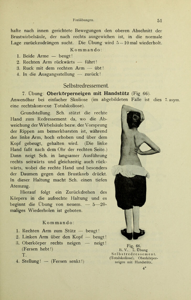 hafte nach innen gerichtete Bewegungen den oberen Abschnitt der Brustwirbelsäule, der nach rechts ausgewichen ist, in die normale Lage zurückzudrängen sucht. Die Übung wird 5 — 10 mal wiederholt. Kommando: 1. Beide Arme — beugt! 2. Rechten Arm rückwärts — führt! 3. Ruck mit dem rechten Arm — übt! 4. In die Ausgangsstellung — zurück! Selbstredressement. 7. Übung: Oberkörperneigen mit Handstütz (Fig 66). Anwendbar bei einfacher Skoliose (im abgebildeten Falle ist dies 7. asym. eine rechtskonvexe Totalskoliose). Grundstellung. Sch. stützt die rechte Hand zum Redressement da, wo die Ab- weichung der Wirbelsäule bezw. der Vorsprung der Rippen am bemerkbarsten ist, während der linke Arm, hoch erhoben und über dem Kopf gebeugt, gehalten wird. (Die linke Hand faßt nach dem Ohr der rechten Seite.) Dann neigt Sch. in langsamer Ausführung rechts seitwärts und gleichzeitig auch rück- wärts, wobei die rechte Hand und besonders der Daumen gegen den Brustkorb drückt. In dieser Haltung macht Sch. einen tiefen Atemzug. Hierauf folgt ein Zurückdrehen des Körpers in die aufrechte Haltung und es beginnt die Übung von neuem. — 5-—20- maliges Wiederholen ist geboten. Kommando: 1. Rechten Arm zum Stütz — beugt! 2. Linken Arm über den Kopf — beugt! 3. Oberkörper rechts neigen — neigt! (Fersen hebt!) T. 4. Stellung! — (Fersen senkt!) Fig. 66. B. Y. 7. Übung Selbstredressement. (Totalskoliose). Oberkörper- neigen mit Handstütz. 4*