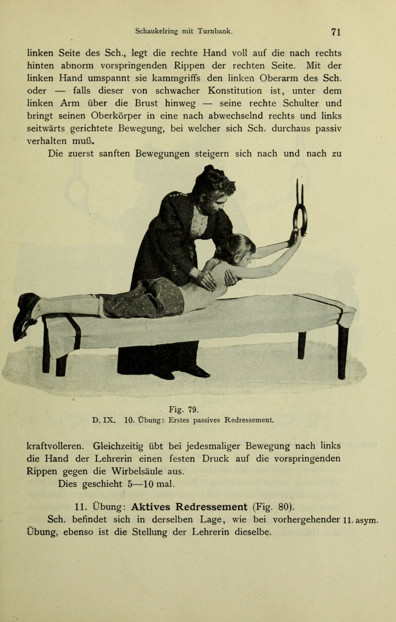 linken Seite des Sch., legt die rechte Hand voll auf die nach rechts hinten abnorm vorspringenden Rippen der rechten Seite. Mit der linken Hand umspannt sie kammgriffs den linken Oberarm des Sch. oder — falls dieser von schwacher Konstitution ist, unter dem linken Arm über die Brust hinweg — seine rechte Schulter und bringt seinen Oberkörper in eine nach abwechselnd rechts und links seitwärts gerichtete Bewegung, bei welcher sich Sch. durchaus passiv verhalten muß. Die zuerst sanften Bewegungen steigern sich nach und nach zu Fig. 79. D. IX. 10. Übung: Erstes passives Redressement. kraftvolleren. Gleichzeitig übt bei jedesmaliger Bewegung nach links die Hand der Lehrerin einen festen Druck auf die vorspringenden Rippen gegen die Wirbelsäule aus. Dies geschieht 5—10 mal. 11. Übung: Aktives Redressement (Fig. 80). Sch. befindet sich in derselben Lage, wie bei vorhergehender li. asym. Übung, ebenso ist die Stellung der Lehrerin dieselbe.