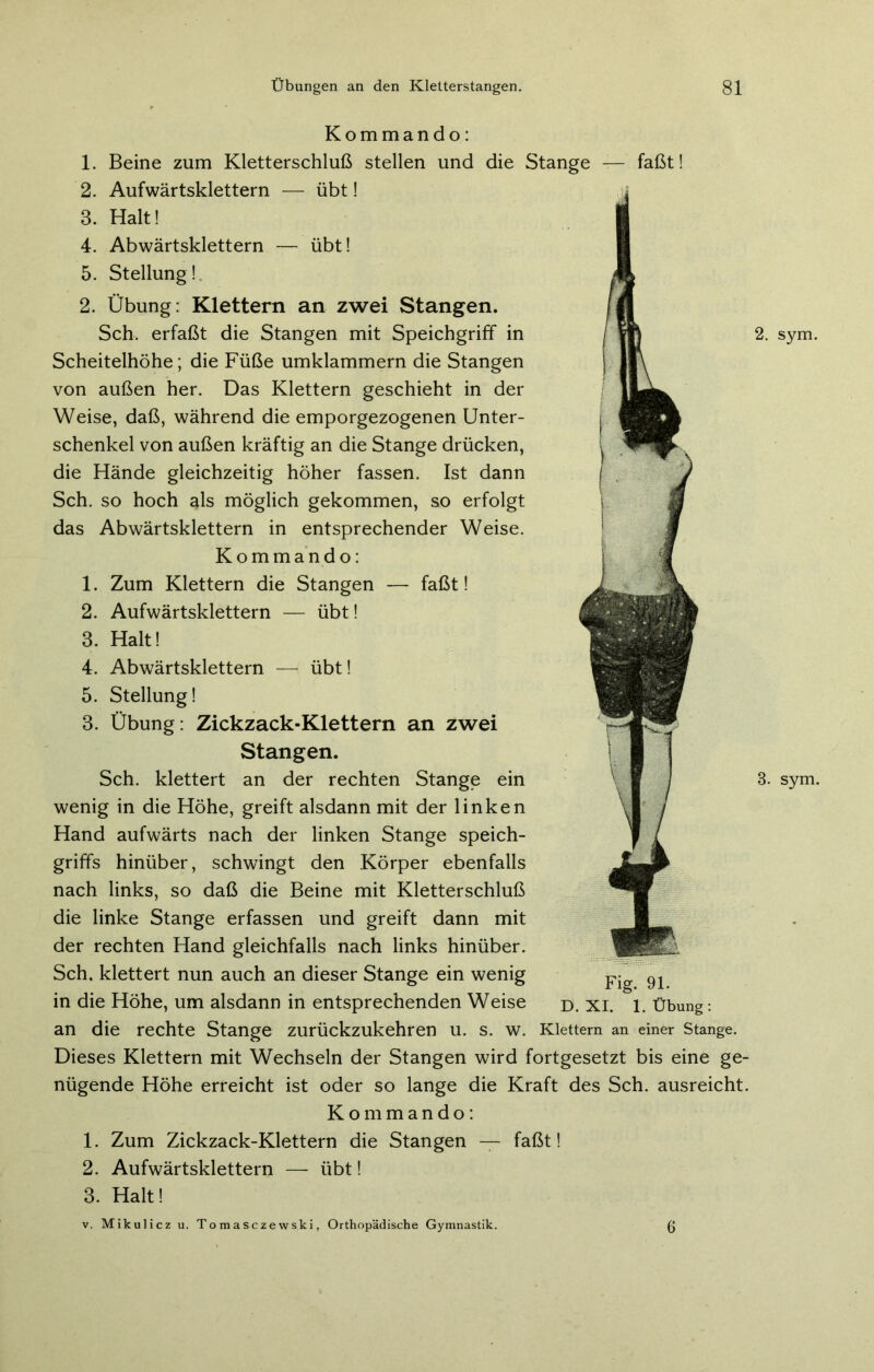 Kommando: 1. Beine zum Kletterschluß stellen und die Stange — faßt! 2. Aufwärtsklettern -— übt! 3. Halt! 4. Abwärtsklettern — übt! 5. Stellung ! 2. Übung: Klettern an zwei Stangen. Sch. erfaßt die Stangen mit Speichgriff in Scheitelhöhe; die Füße umklammern die Stangen von außen her. Das Klettern geschieht in der Weise, daß, während die emporgezogenen Unter- schenkel von außen kräftig an die Stange drücken, die Hände gleichzeitig höher fassen. Ist dann Sch. so hoch als möglich gekommen, so erfolgt das Abwärtsklettern in entsprechender Weise. Kommando: 1. Zum Klettern die Stangen — faßt! 2. Aufwärtsklettern — übt! 3. Halt! 4. Abwärtsklettern —i übt! 5. Stellung! 3. Übung: Zickzack-Klettern an zwei Stangen. Sch. klettert an der rechten Stange ein wenig in die Höhe, greift alsdann mit der linken Hand aufwärts nach der linken Stange speich- griffs hinüber, schwingt den Körper ebenfalls nach links, so daß die Beine mit Kletterschluß die linke Stange erfassen und greift dann mit der rechten Hand gleichfalls nach links hinüber. Sch. klettert nun auch an dieser Stange ein wenig in die Höhe, um alsdann in entsprechenden Weise an die rechte Stange zurückzukehren u. s. w. Klettern an einer Stange. Dieses Klettern mit Wechseln der Stangen wird fortgesetzt bis eine ge- nügende Höhe erreicht ist oder so lange die Kraft des Sch. ausreicht. Kommando: 1. Zum Zickzack-Klettern die Stangen — faßt! 2. Aufwärtsklettern — übt! 3. Halt! v. Mikulicz u. Tomasczewski, Orthopädische Gymnastik. (j Fig. 91. D. XI. 1. Übung: . sym. I. sym.