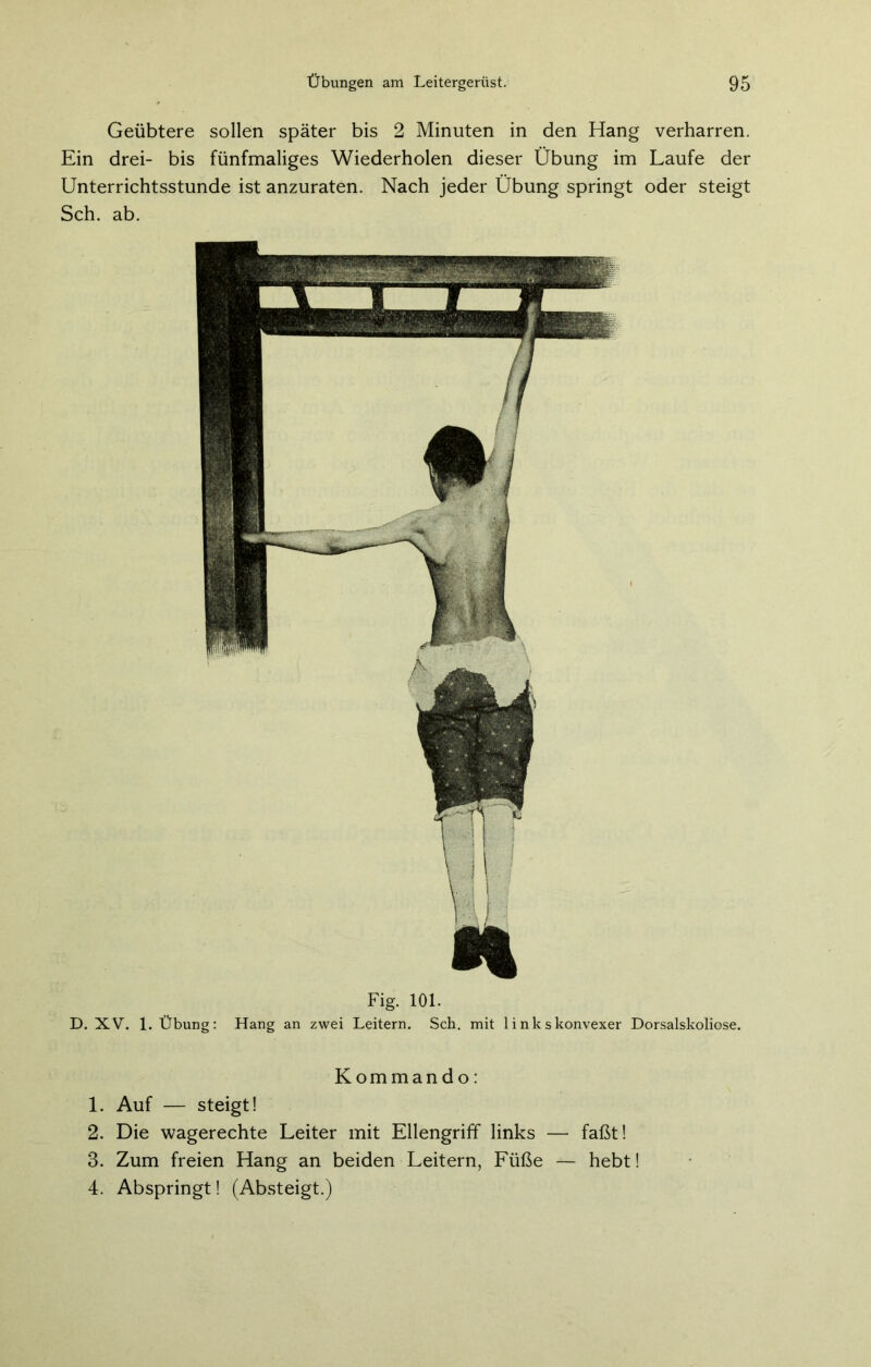 Geübtere sollen später bis 2 Minuten in den Hang verharren. Ein drei- bis fünfmaliges Wiederholen dieser Übung im Laufe der Unterrichtsstunde ist anzuraten. Nach jeder Übung springt oder steigt Sch. ab. Fig. 101. D. XV. 1. Übung: Hang an zwei Leitern. Sch. mit 1 ink skonvexer Dorsalskoliose. Kommando: 1. Auf — steigt! 2. Die wagerechte Leiter mit Ellengriff links — faßt! 3. Zum freien Hang an beiden Leitern, Füße — hebt! 4. Abspringt! (Absteigt.)