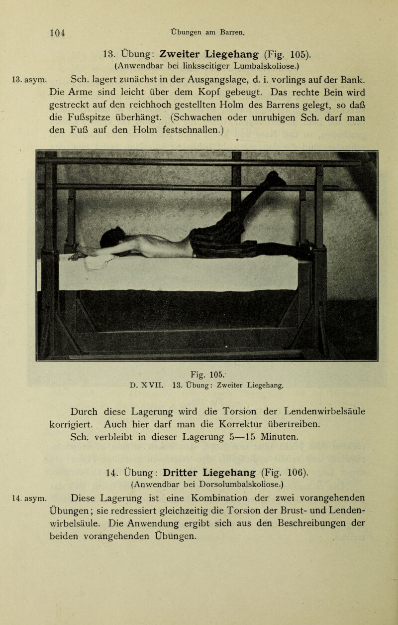 13. Übung: Zweiter Liegehang (Fig. 105). (Anwendbar bei linksseitiger Lumbalskoliose.) 13. asym. Sch. lagert zunächst in der Ausgangslage, d. i. vorlings auf der Bank. Die Arme sind leicht über dem Kopf gebeugt. Das rechte Bein wird gestreckt auf den reichhoch gestellten Holm des Barrens gelegt, so daß die Fußspitze überhängt. (Schwachen oder unruhigen Sch. darf man den Fuß auf den Holm festschnallen.) Fig. 105/ D. XVII. 13. Übung: Zweiter Liegehang. Durch diese Lagerung wird die Torsion der Lendenwirbelsäule korrigiert. Auch hier darf man die Korrektur übertreiben. Sch. verbleibt in dieser Lagerung 5—15 Minuten. 14. Übung: Dritter Liegehang (Fig. 106). (Anwendbar bei Dorsolumbalskoliose.) 14. asym. Diese Lagerung ist eine Kombination der zwei vorangehenden Übungen; sie redressiert gleichzeitig die Torsion der Brust- und Lenden- wirbelsäule. Die Anwendung ergibt sich aus den Beschreibungen der beiden vorangehenden Übungen.